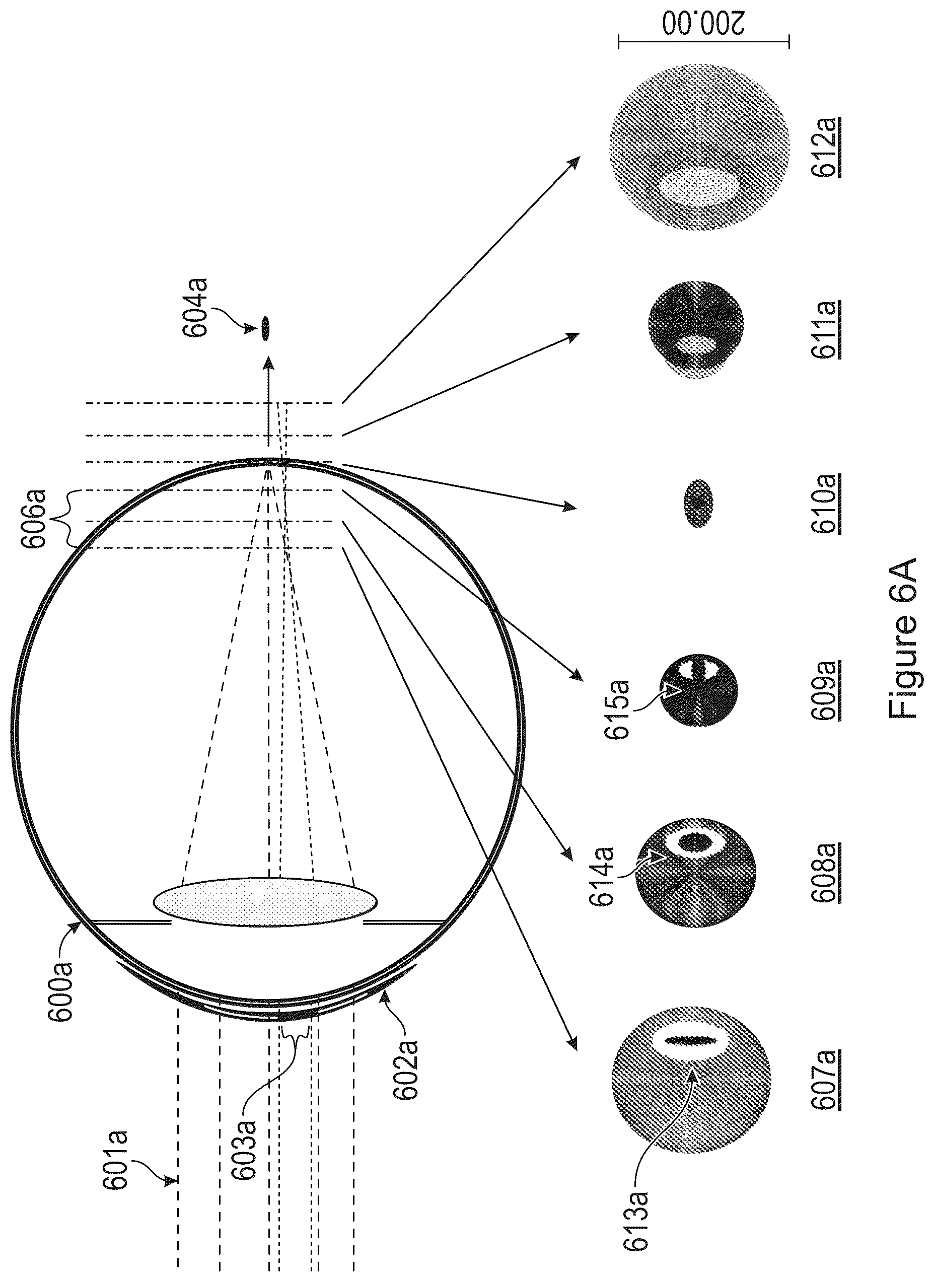 Patent US12345961 Figure 6 – Freeform contact lens solution for myopia