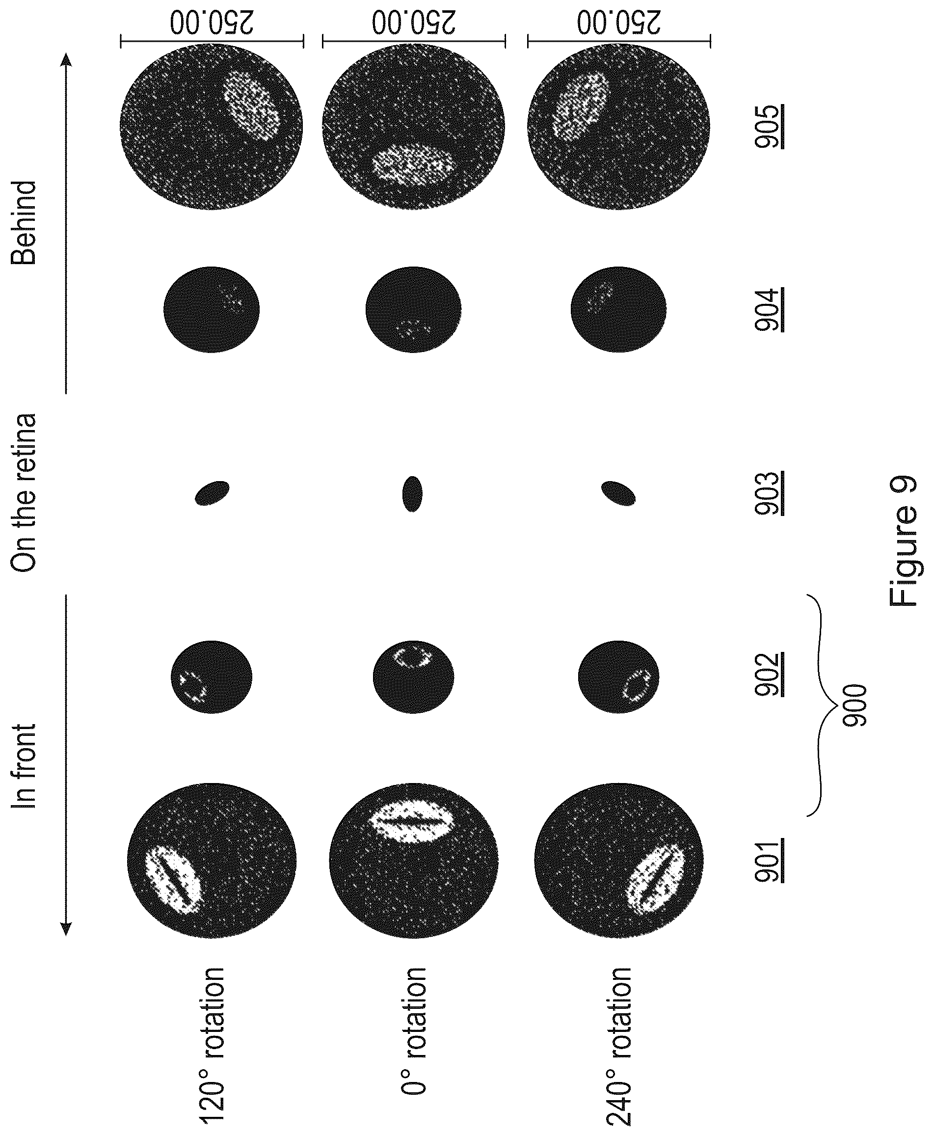 Patent US12345961 Figure 9 – Freeform contact lens solution for myopia