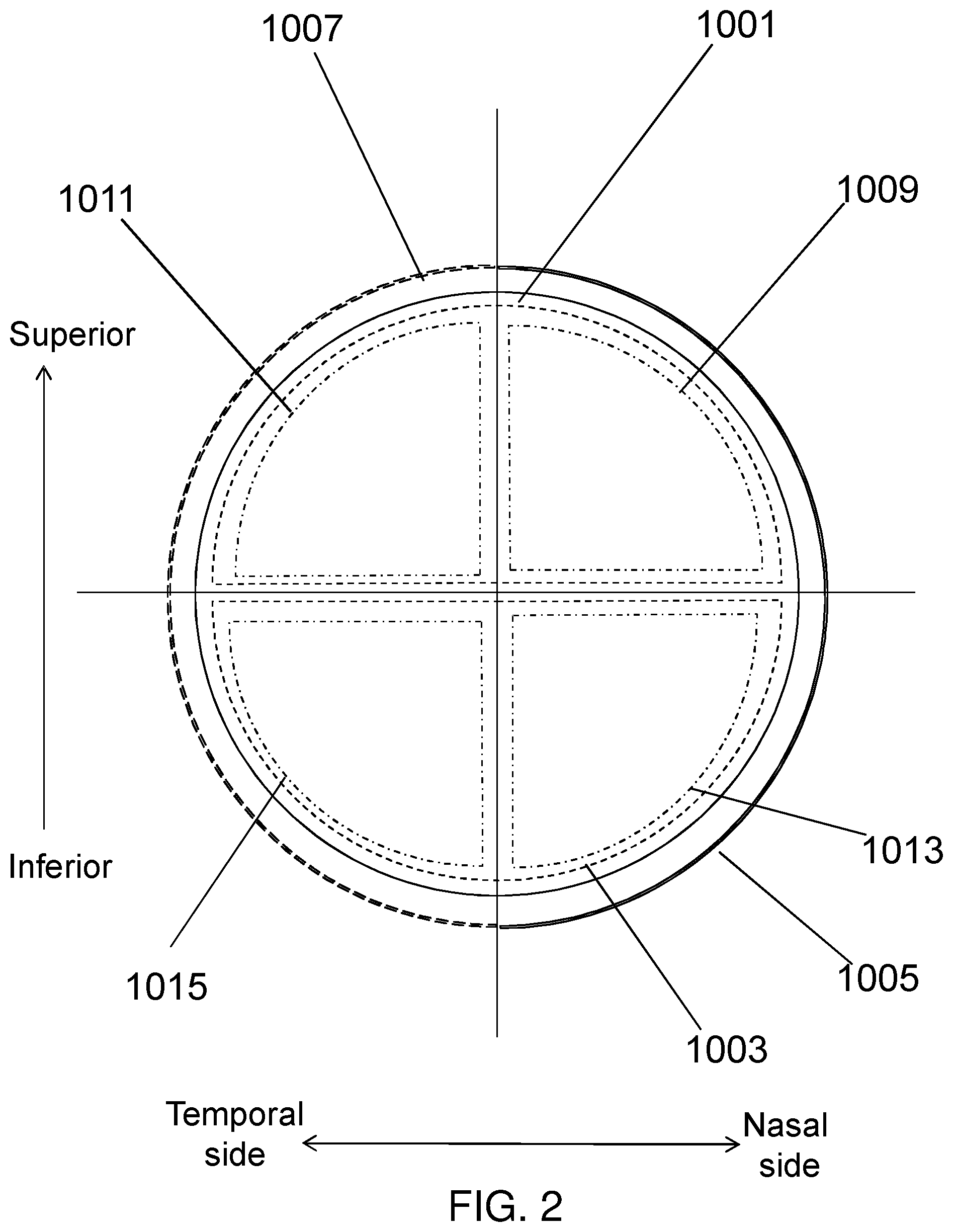 Patent US12345962 Figure 2 – Methods of increased contact lens rotation