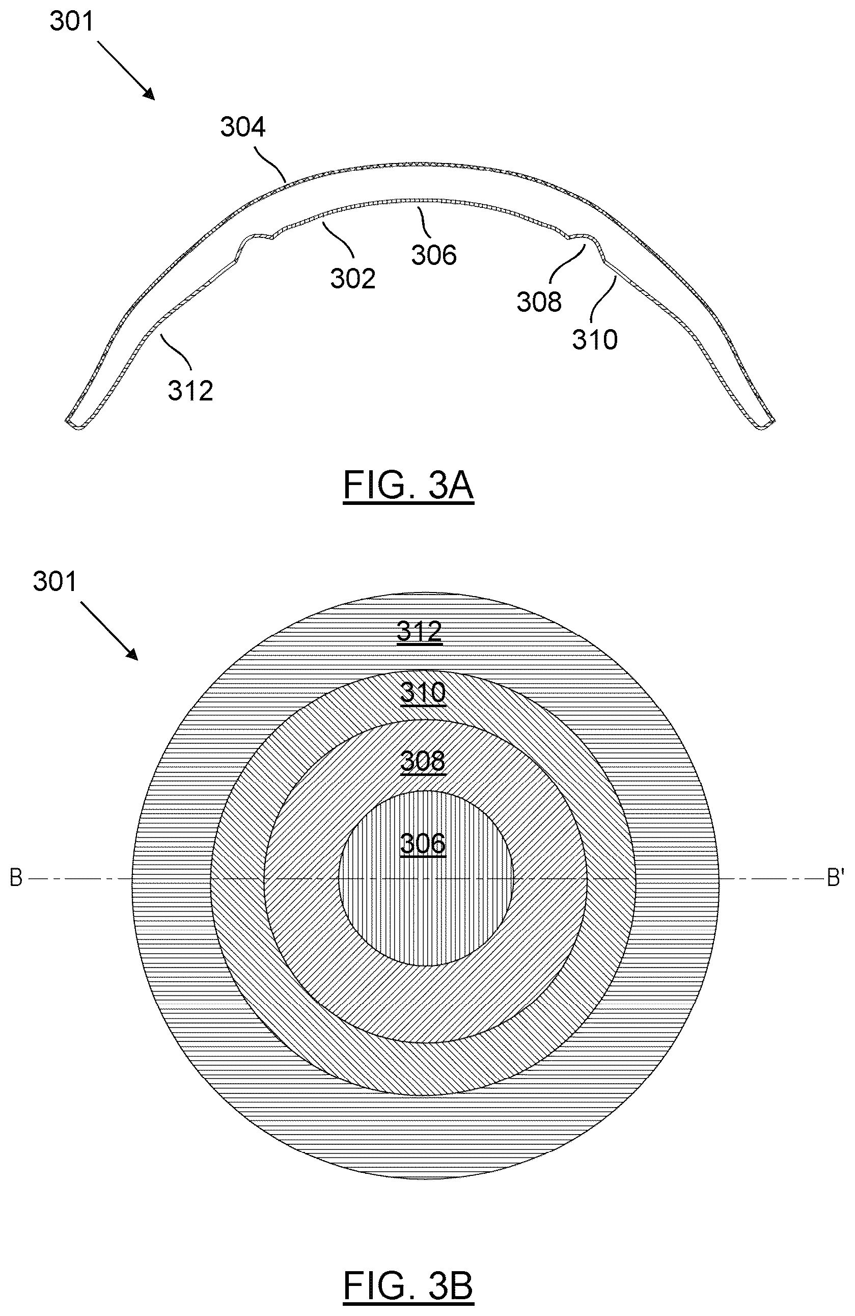 Patent US12345963 Figure 3 – Orthokeratology contact lenses and related methods