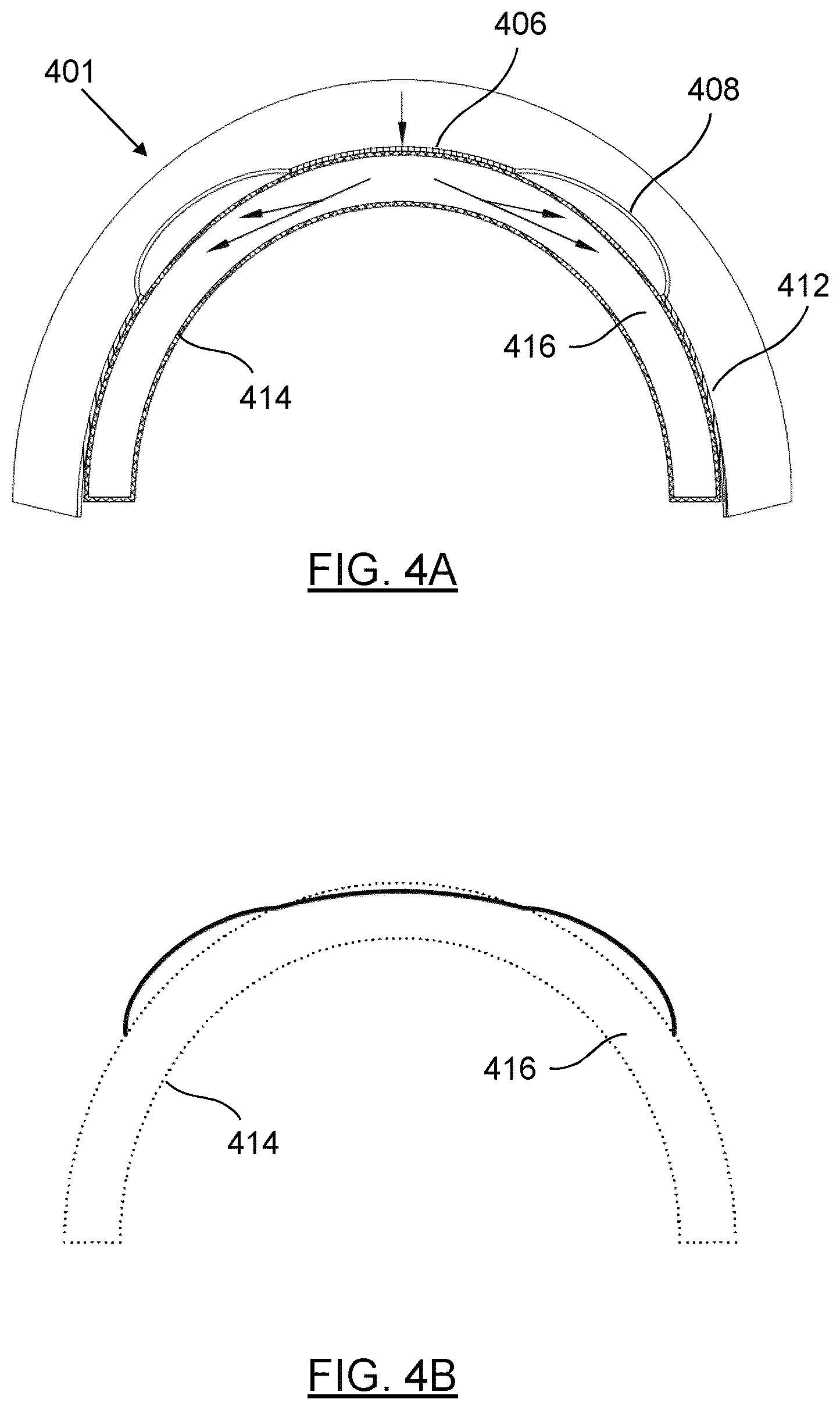 Patent US12345963 Figure 4 – Orthokeratology contact lenses and related methods