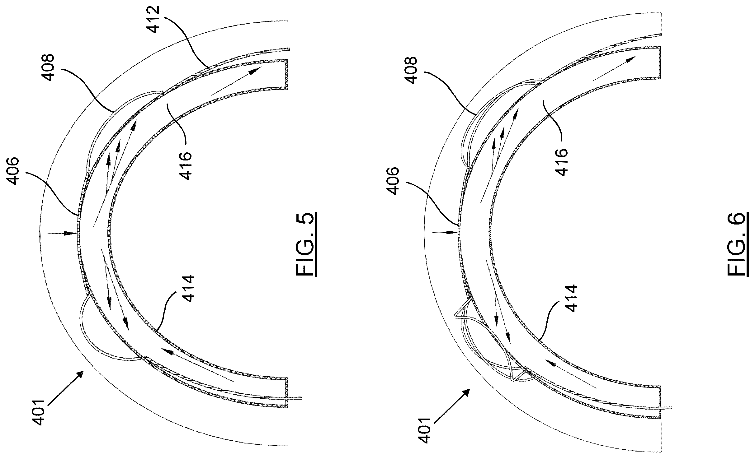 Patent US12345963 Figure 5 – Orthokeratology contact lenses and related methods