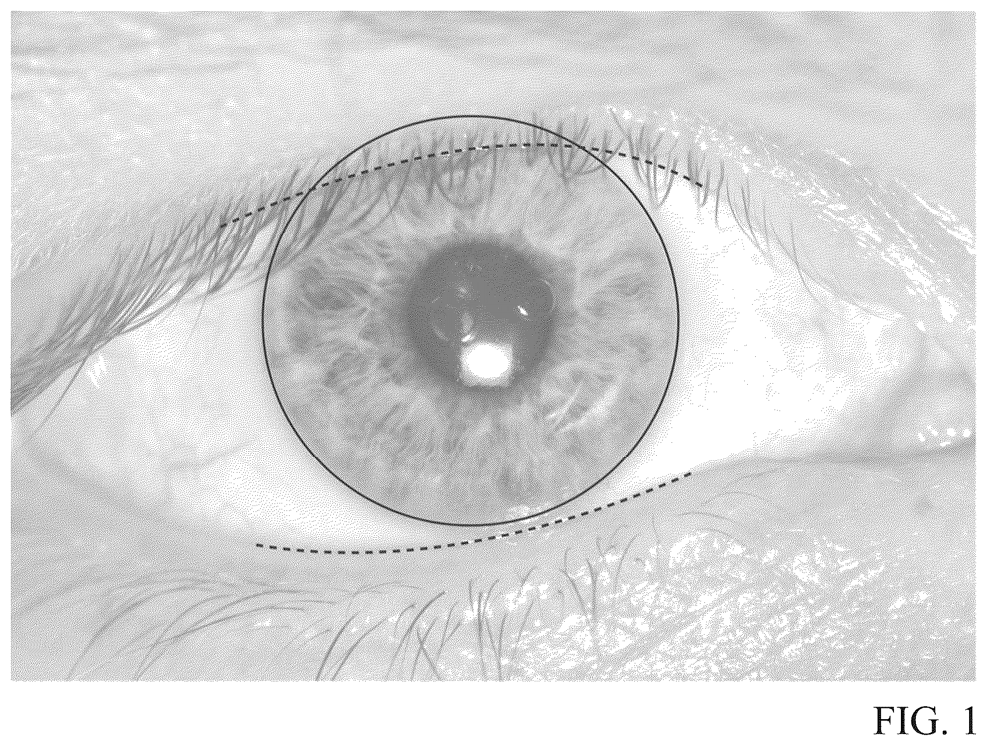 Patent US12345964 Figure 1 – Toric contact lens stabilization design based on thickness gradients orthogonal to eyelid margin