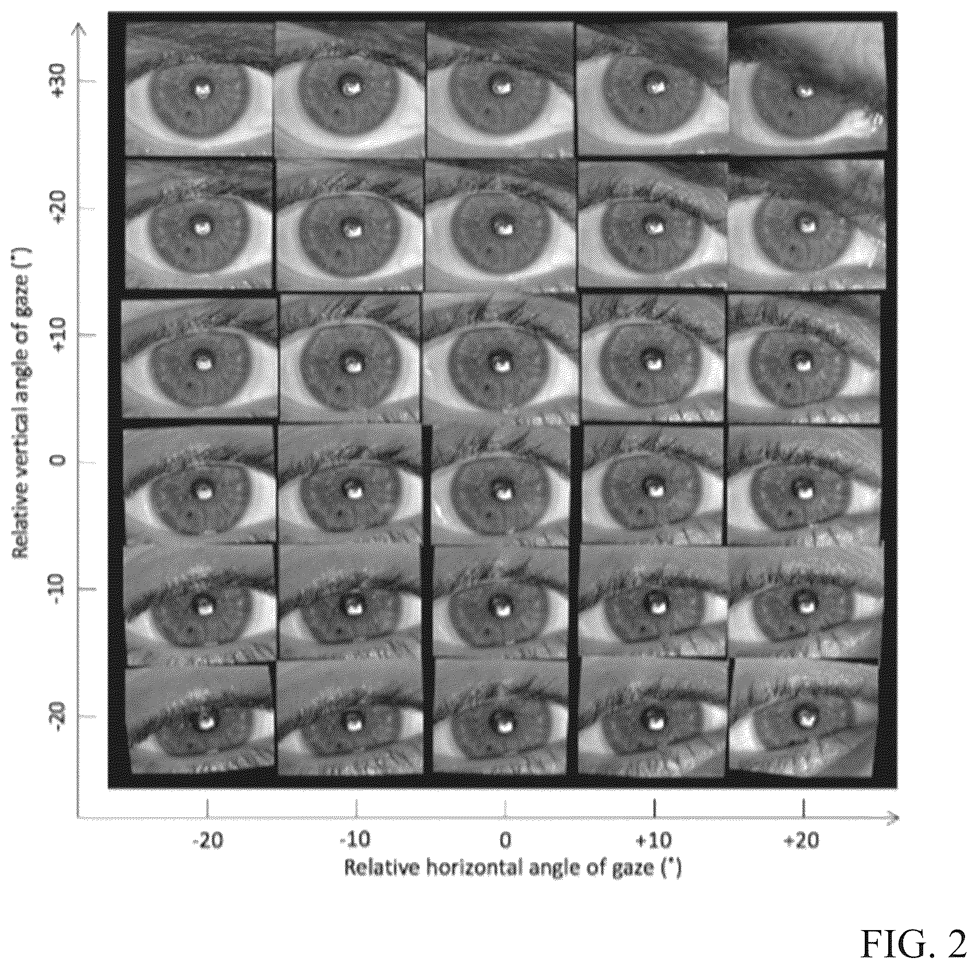 Patent US12345964 Figure 2 – Toric contact lens stabilization design based on thickness gradients orthogonal to eyelid margin