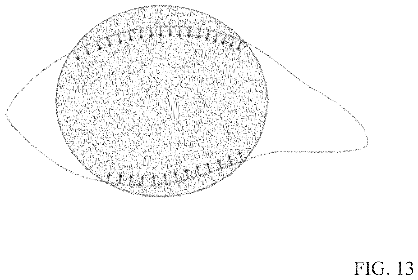 Patent US12345964 Figure 13 – Toric contact lens stabilization design based on thickness gradients orthogonal to eyelid margin