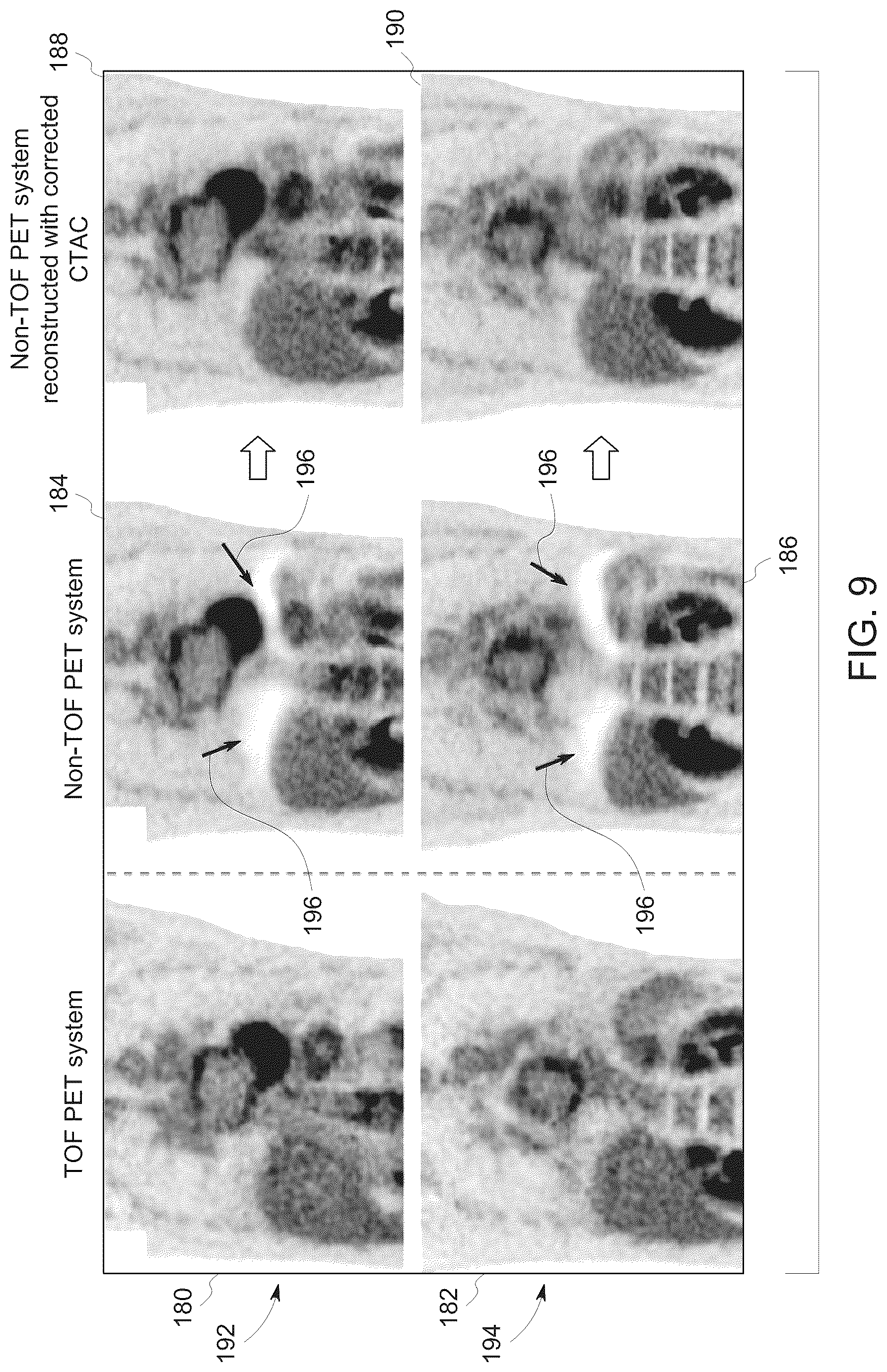 Patent US12347001 Figure 8 – System and method for PET-CT image artifact evaluation and correction