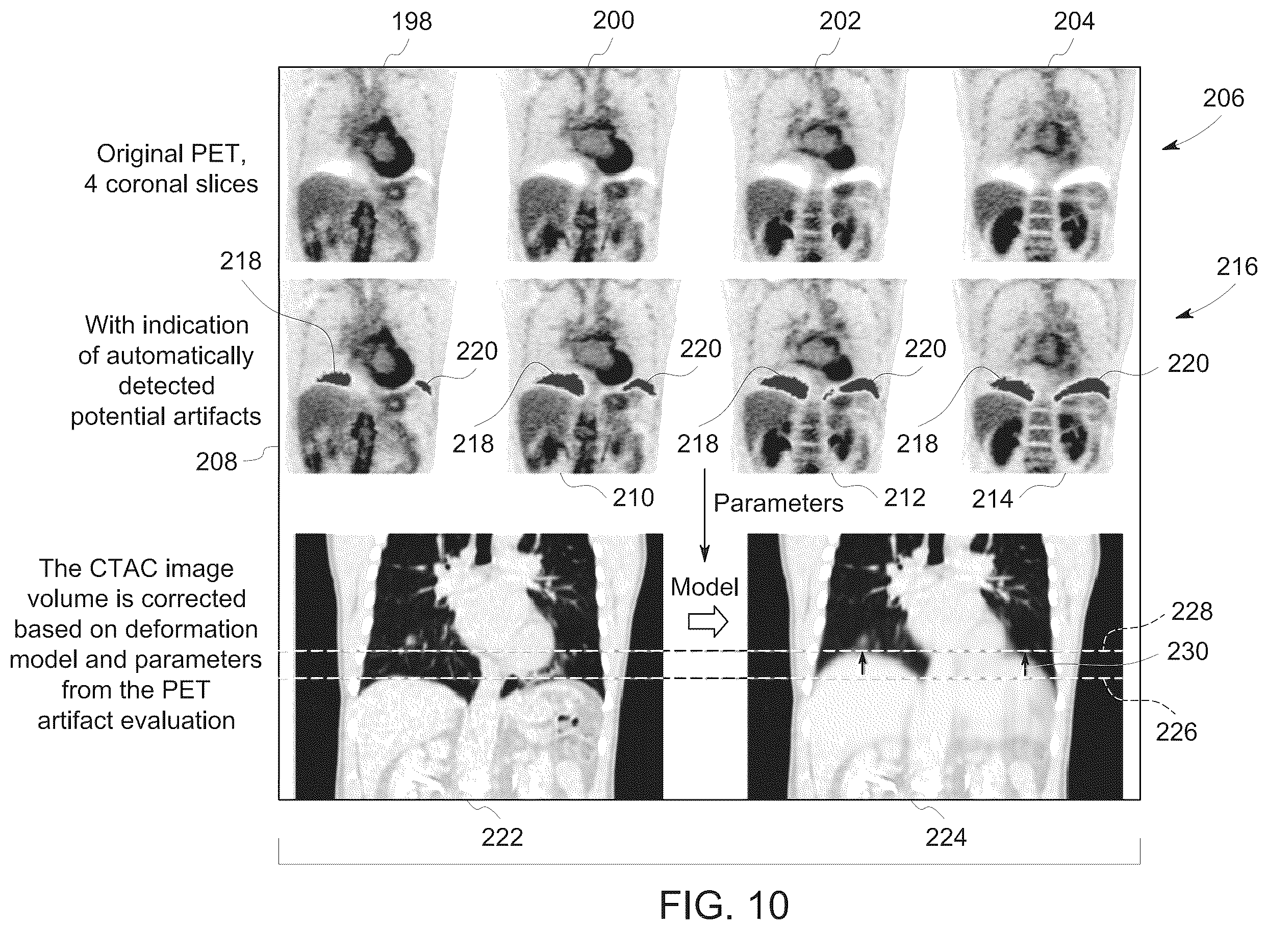 Patent US12347001 Figure 9 – System and method for PET-CT image artifact evaluation and correction