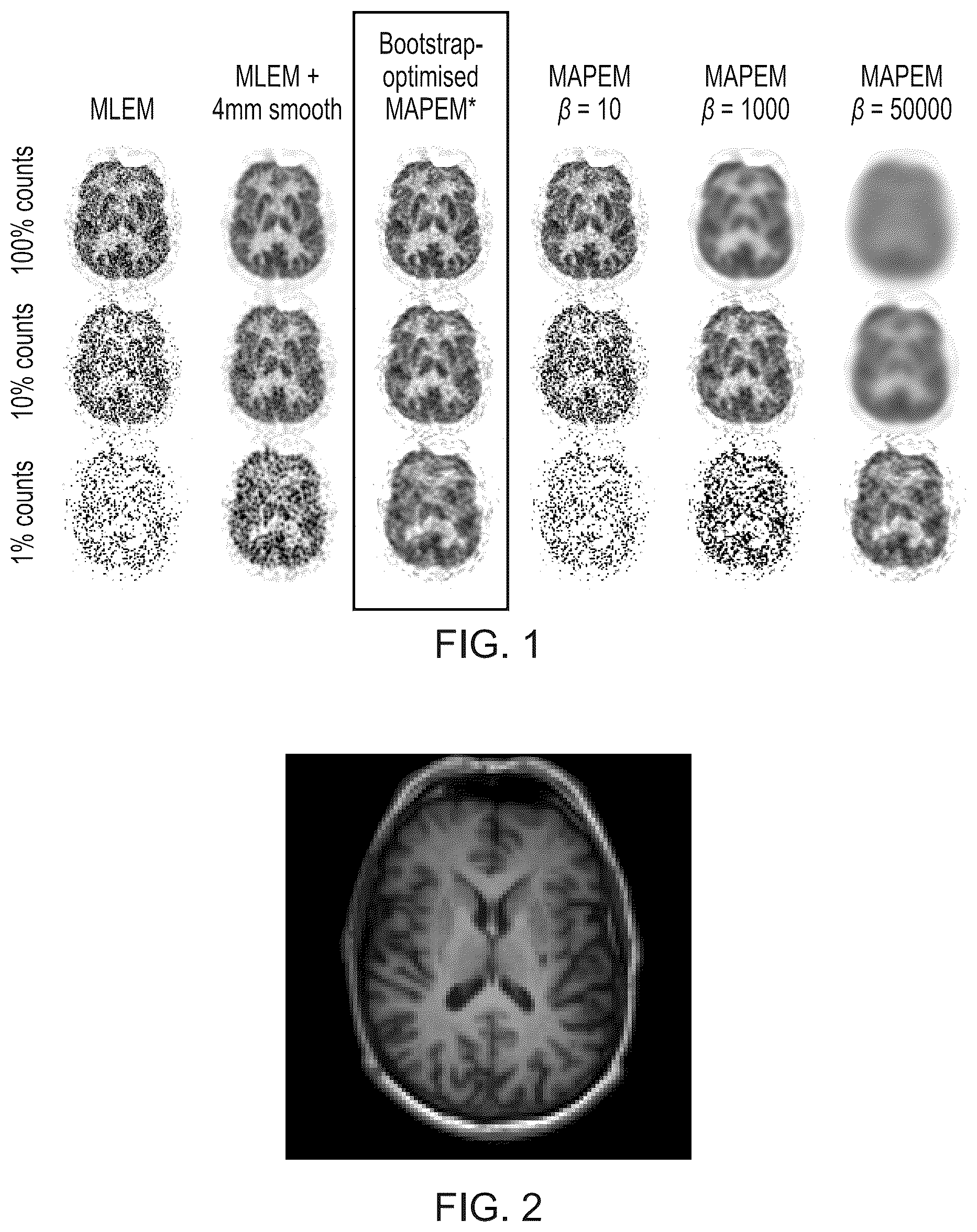Patent US12347073 Figure 1 – Image reconstruction