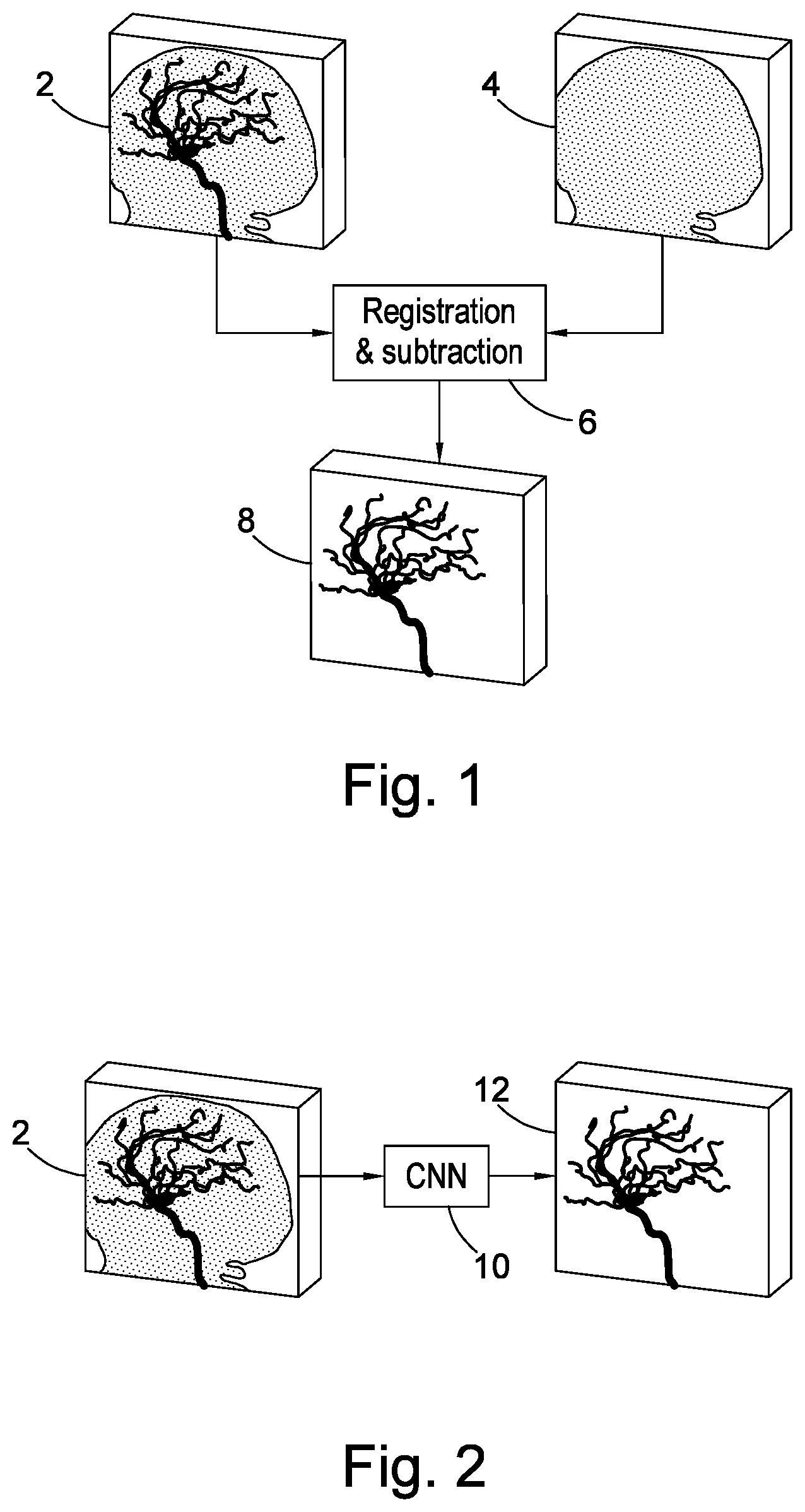 Patent US12347101 — Method and apparatus for producing contrained medical image data — Figure 1