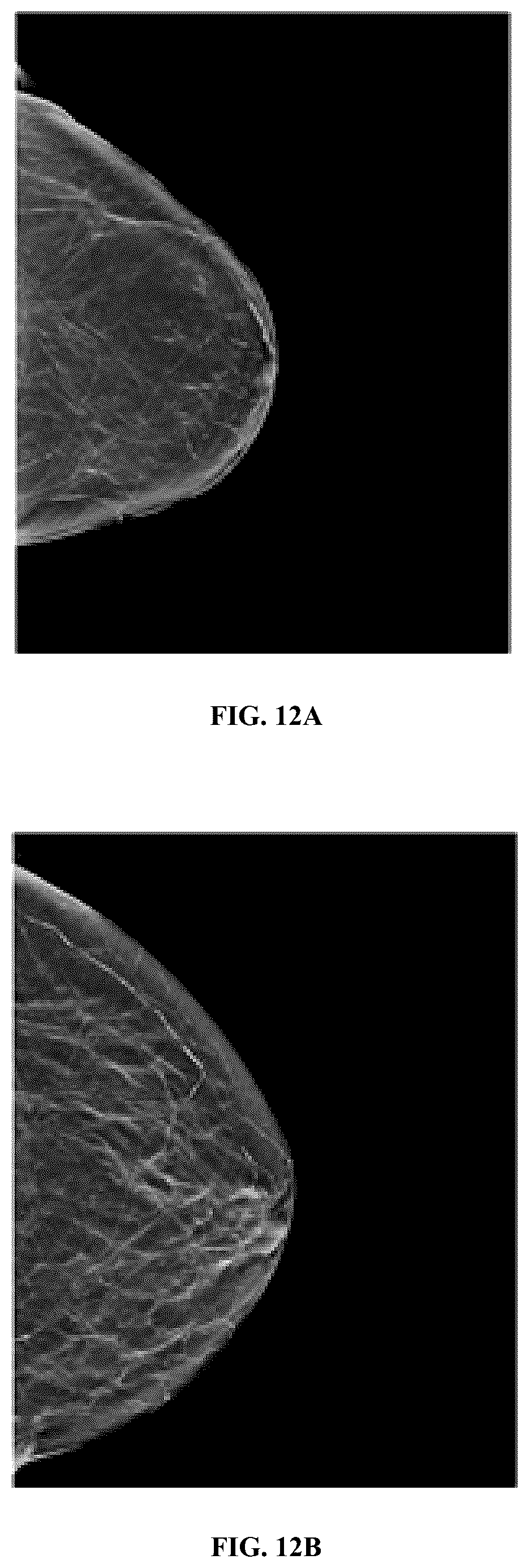 Patent US12347104 Figure 15 – Methods and systems for performing real-time radiology