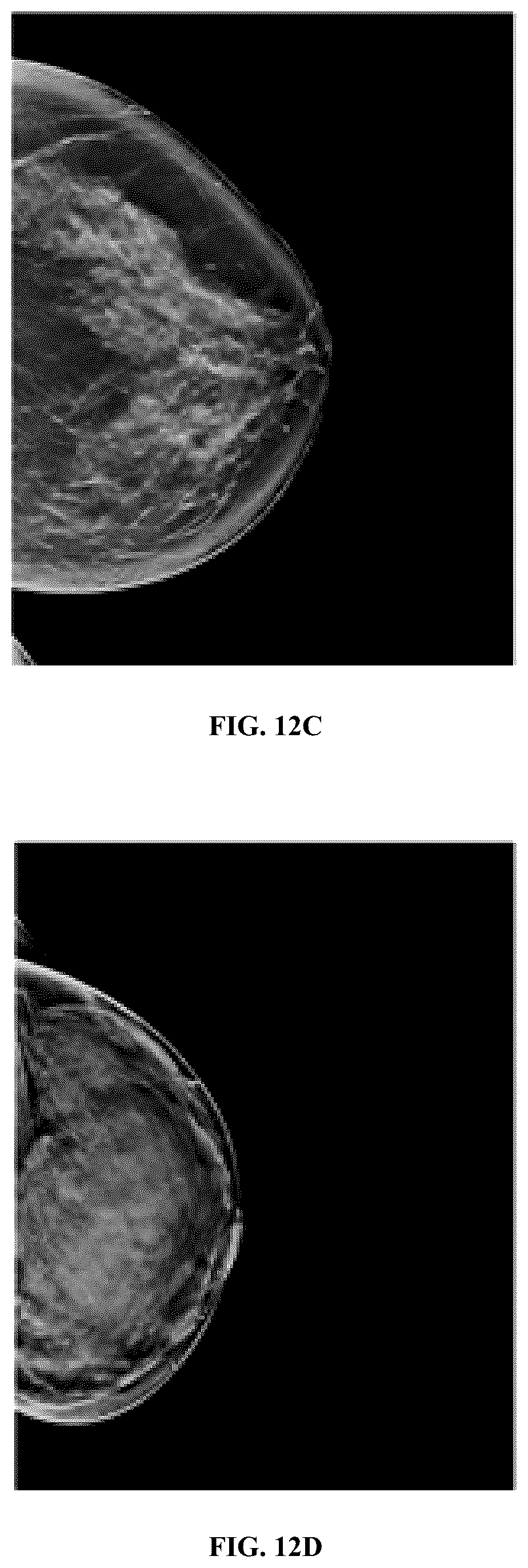 Patent US12347104 Figure 16 – Methods and systems for performing real-time radiology