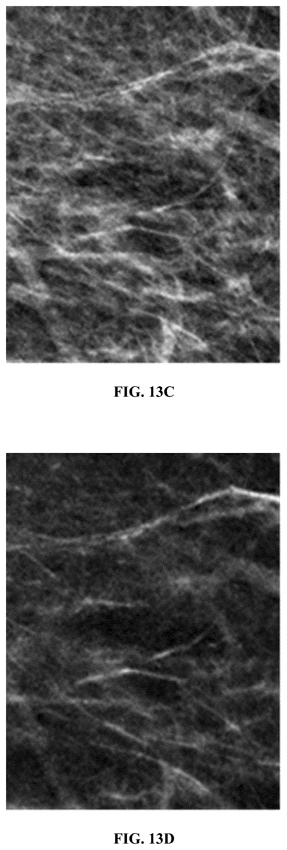 Patent US12347104 Figure 18 – Methods and systems for performing real-time radiology