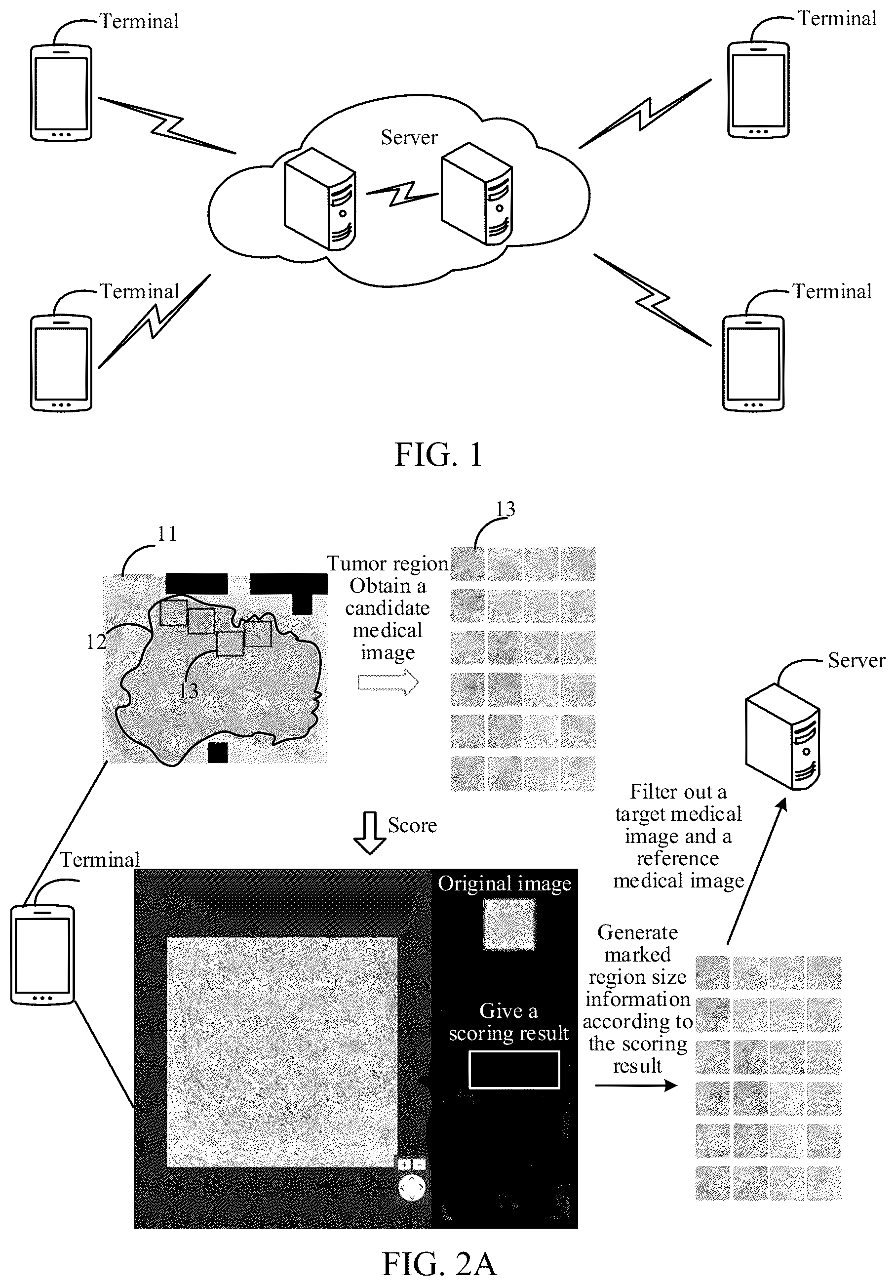 Patent US12347107 Figure 1 – Medical image processing method and apparatus, device, storage medium, and product