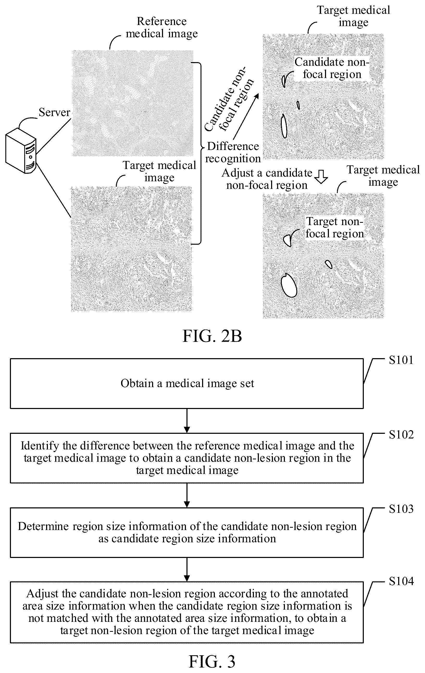 Patent US12347107 Figure 2 – Medical image processing method and apparatus, device, storage medium, and product