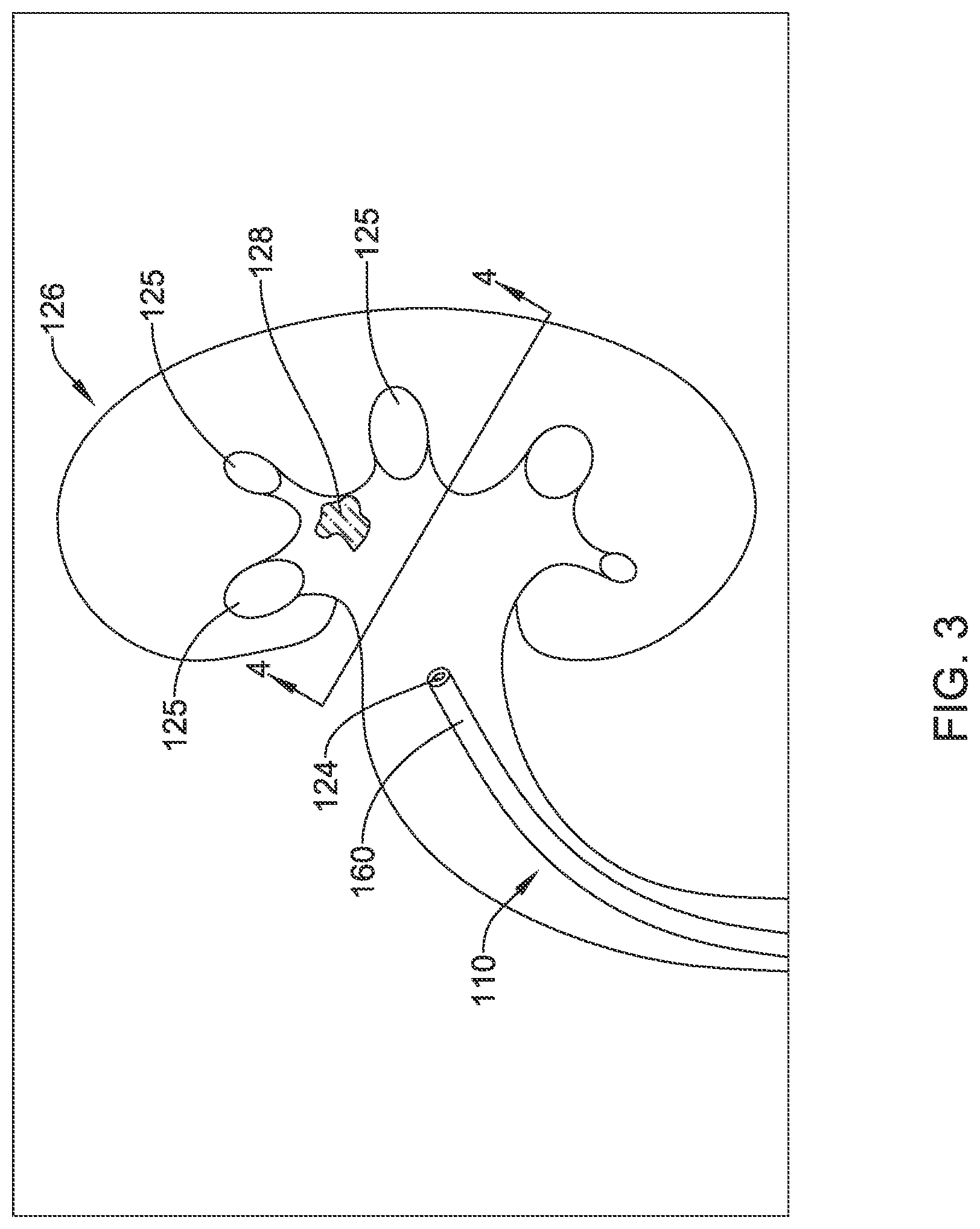 Patent US12347123 Figure 3 – Method of robust surface and depth estimation