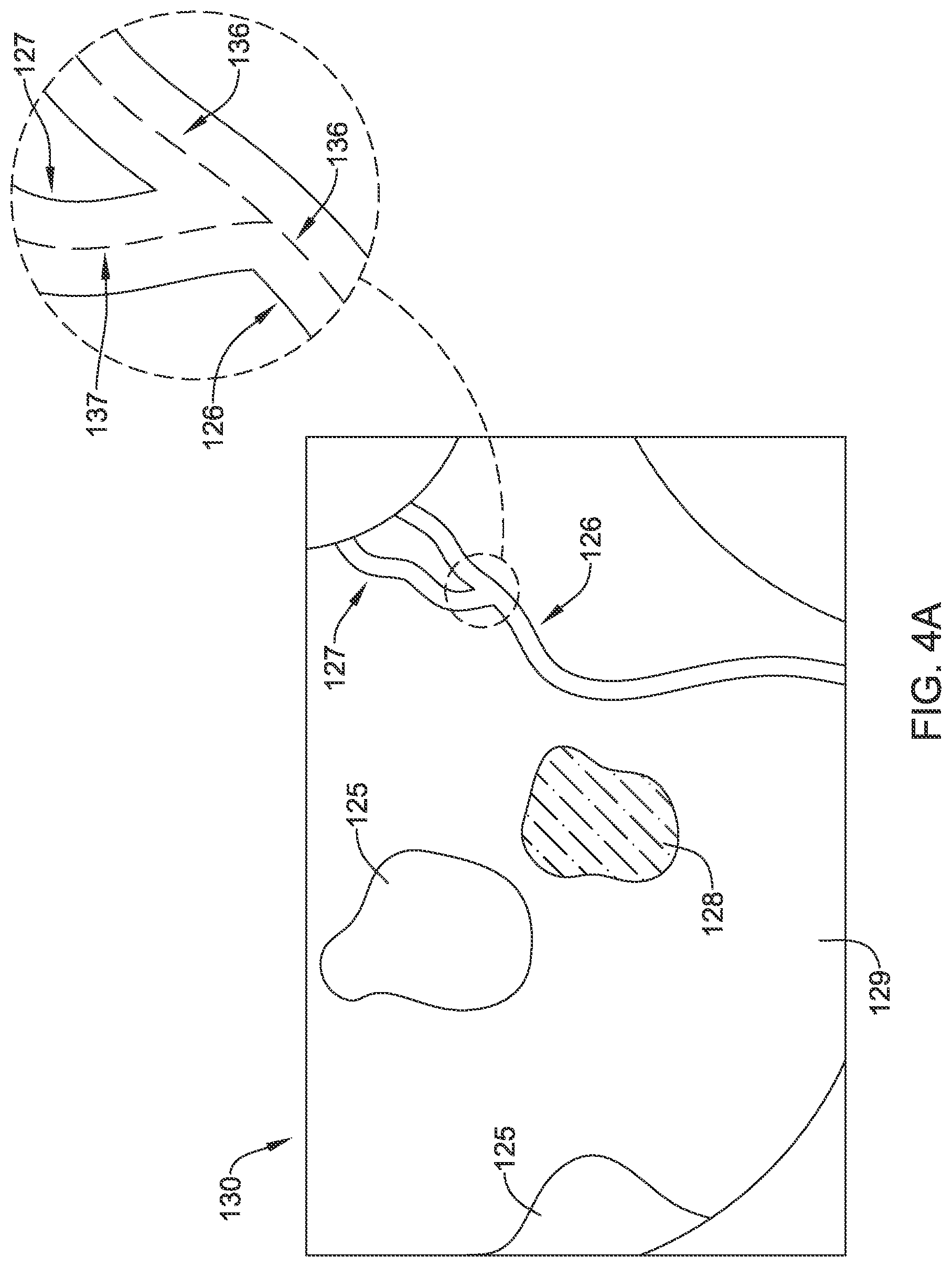 Patent US12347123 Figure 4 – Method of robust surface and depth estimation