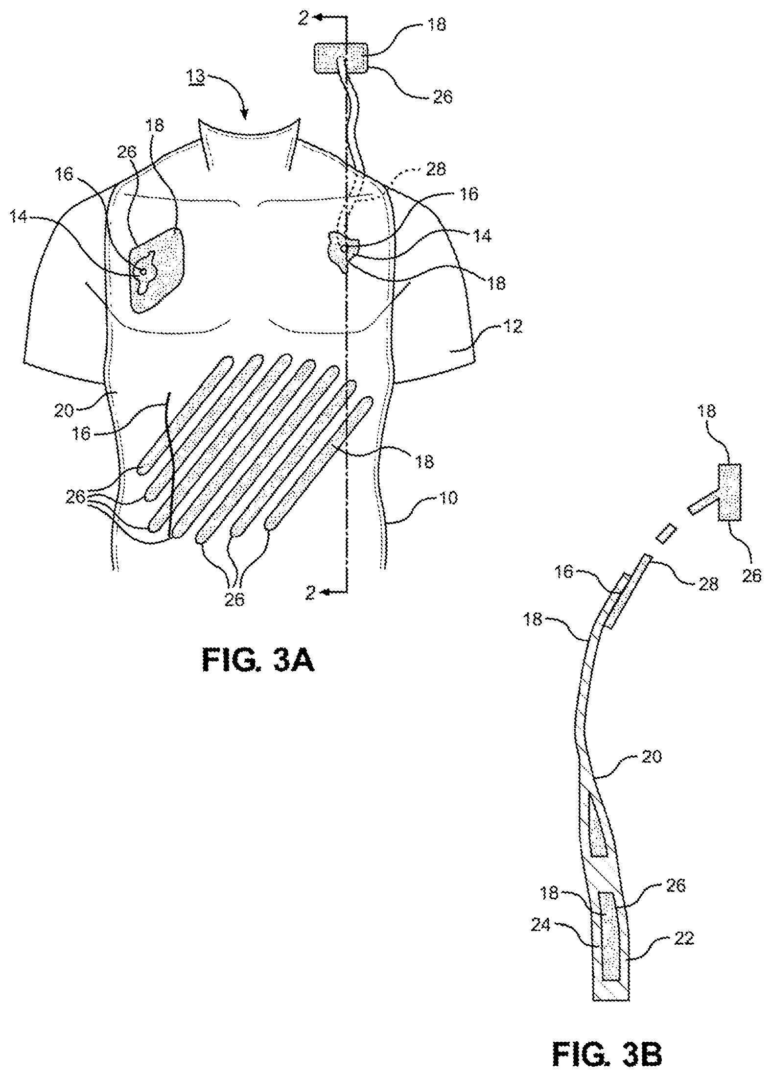 Patent US12347338 Figure 3 – Prosthetic internal organ module