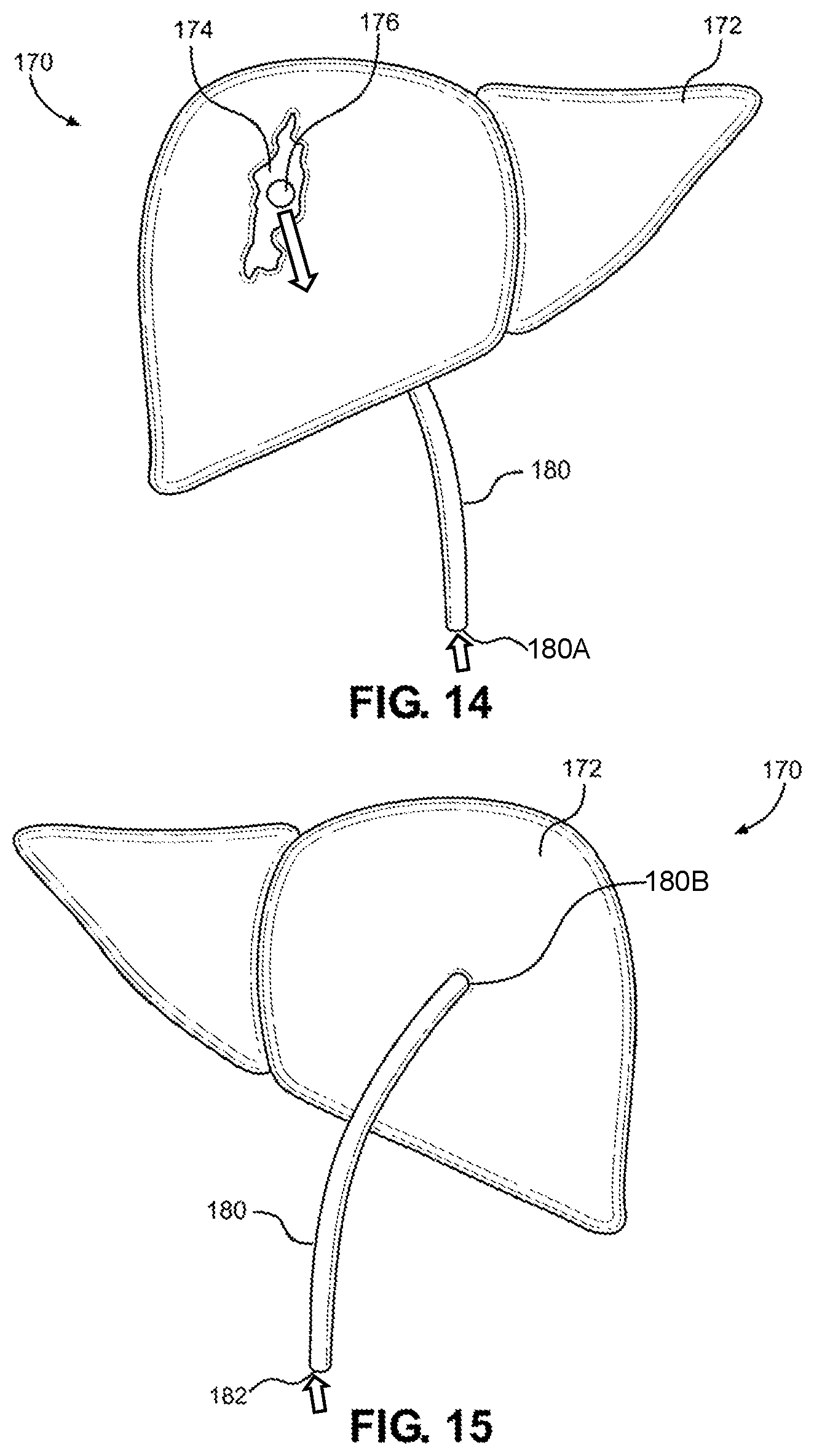 Patent US12347338 Figure 10 – Prosthetic internal organ module