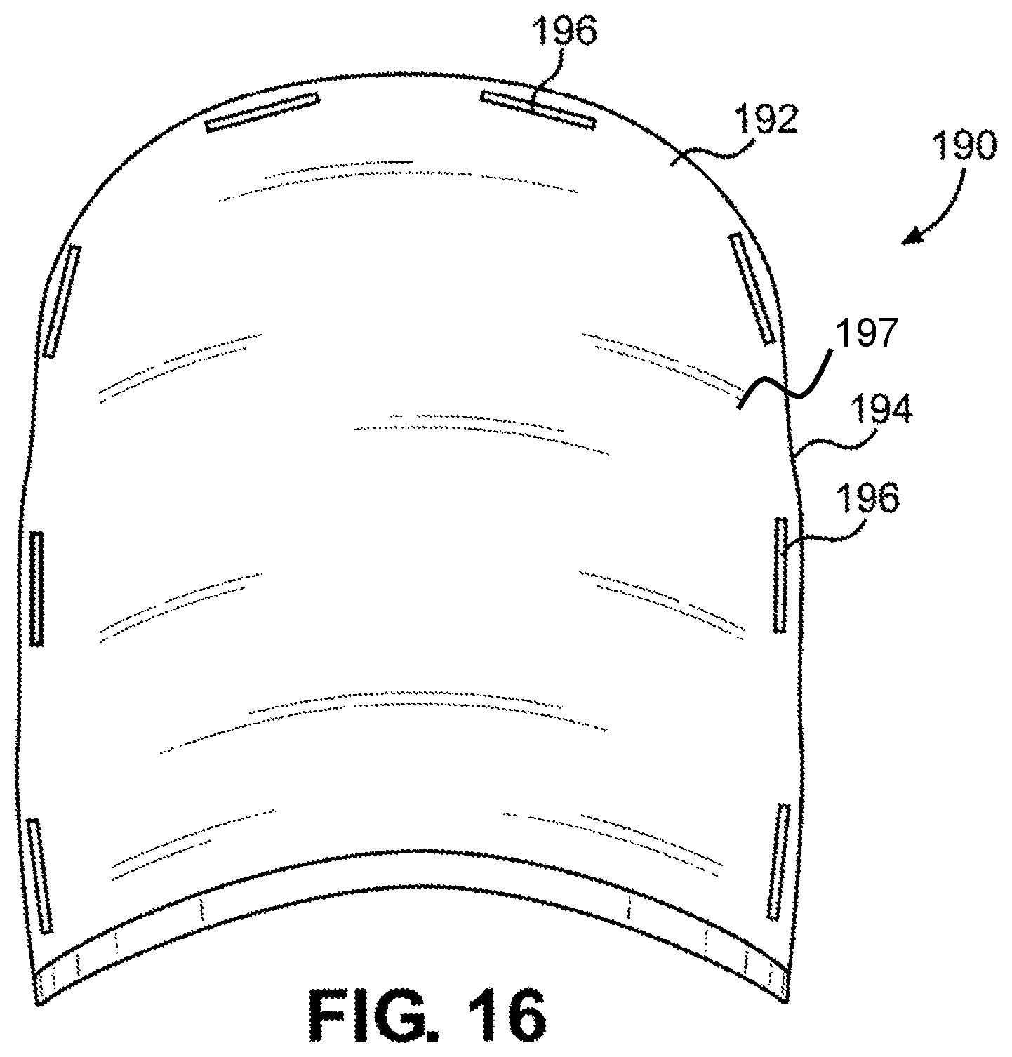 Patent US12347338 Figure 11 – Prosthetic internal organ module