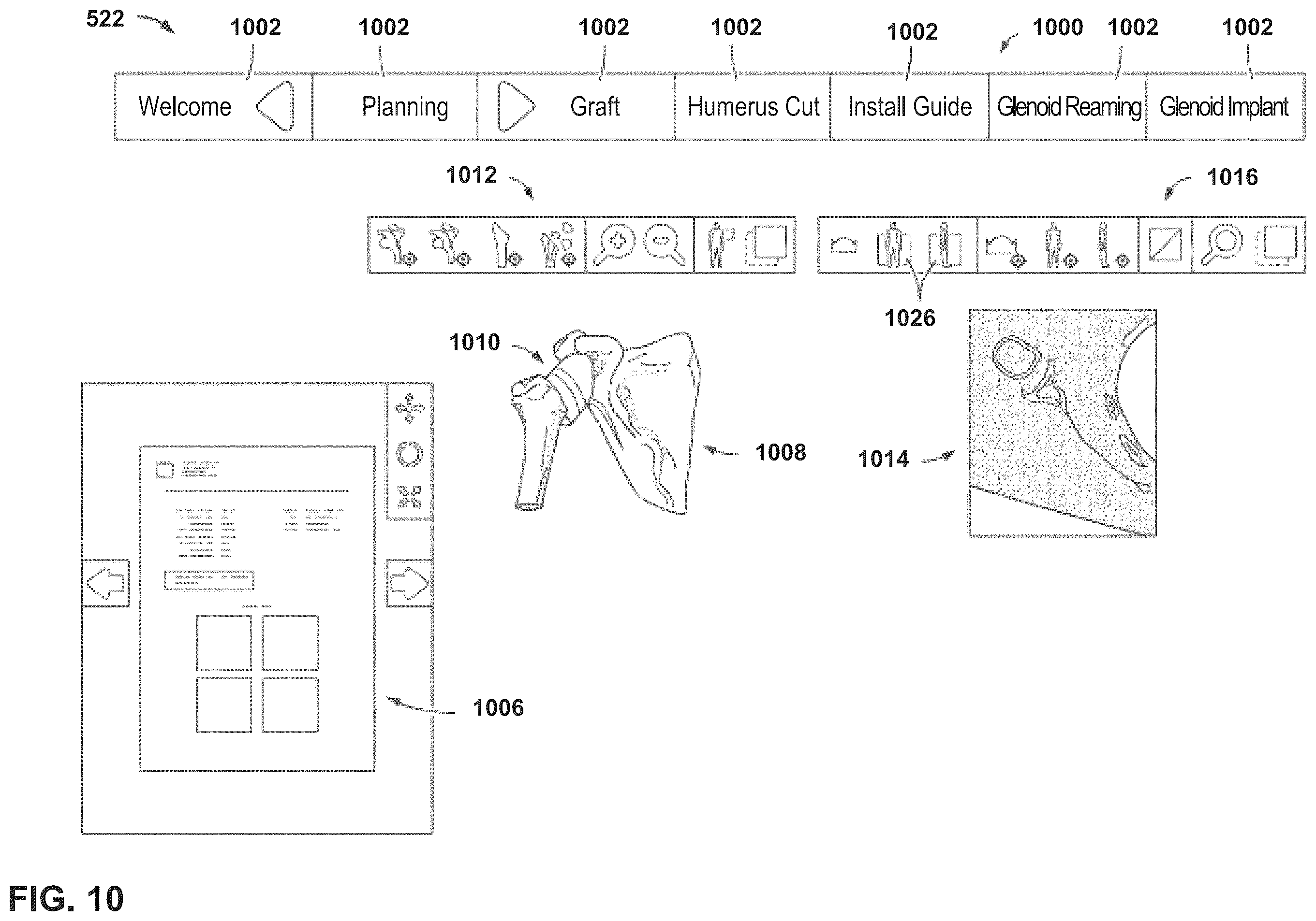Patent US12347545 Figure 9 – Automated instrument or component assistance using externally controlled light sources in orthopedic surgical procedures