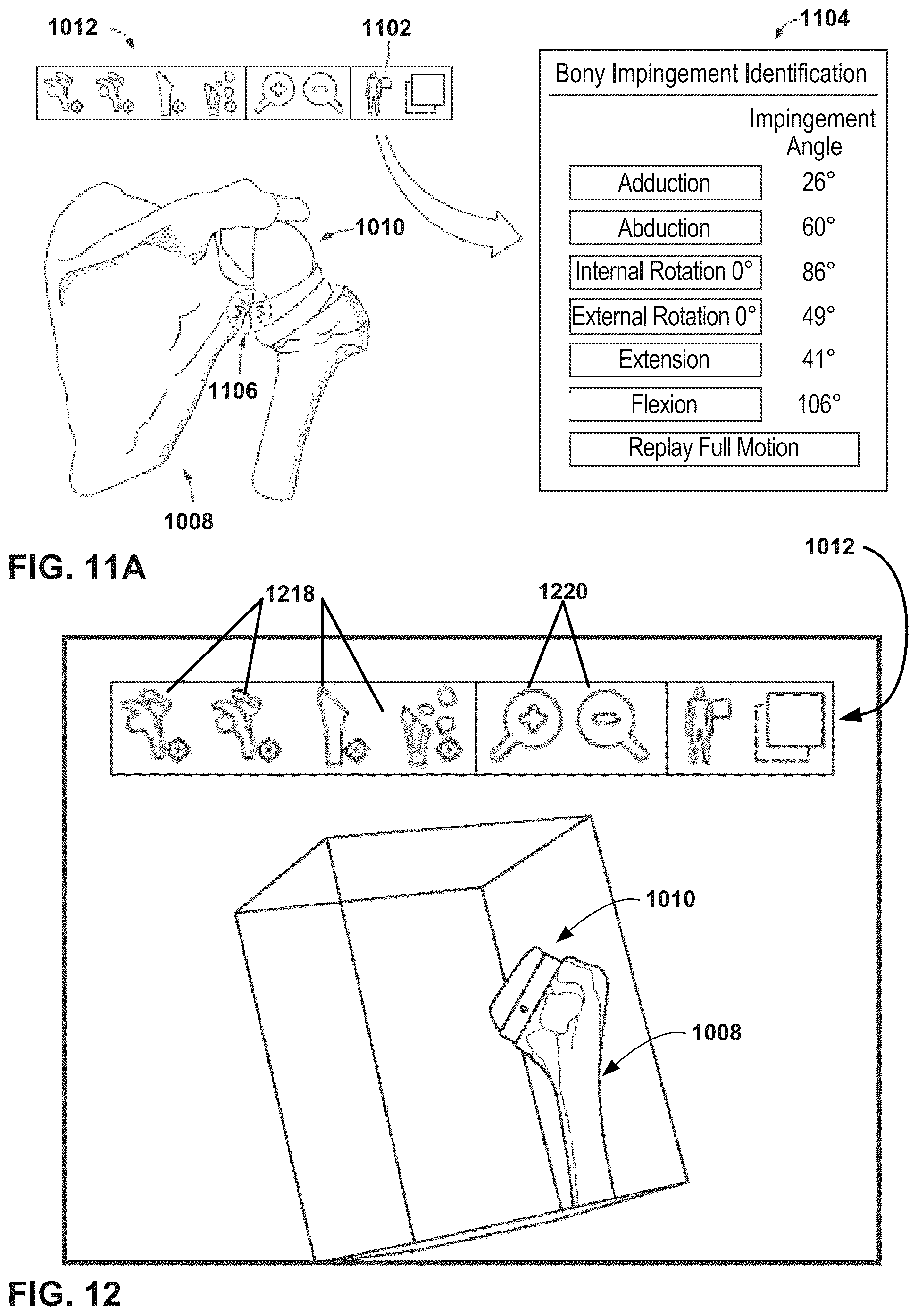 Patent US12347545 Figure 10 – Automated instrument or component assistance using externally controlled light sources in orthopedic surgical procedures
