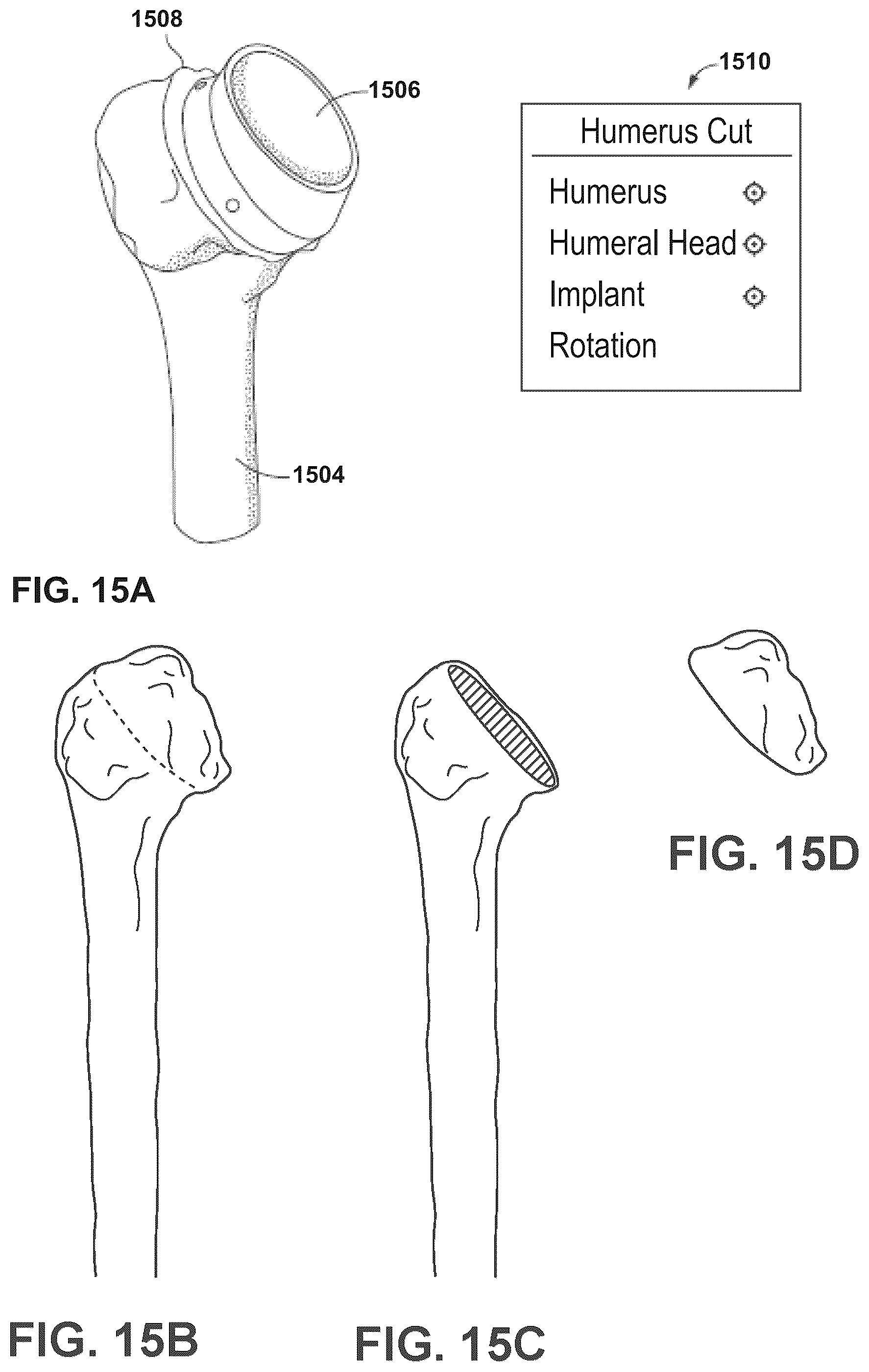 Patent US12347545 Figure 13 – Automated instrument or component assistance using externally controlled light sources in orthopedic surgical procedures