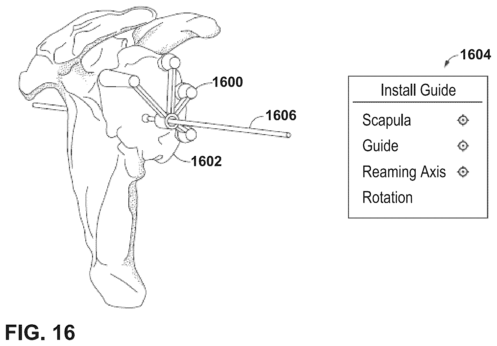 Patent US12347545 Figure 14 – Automated instrument or component assistance using externally controlled light sources in orthopedic surgical procedures