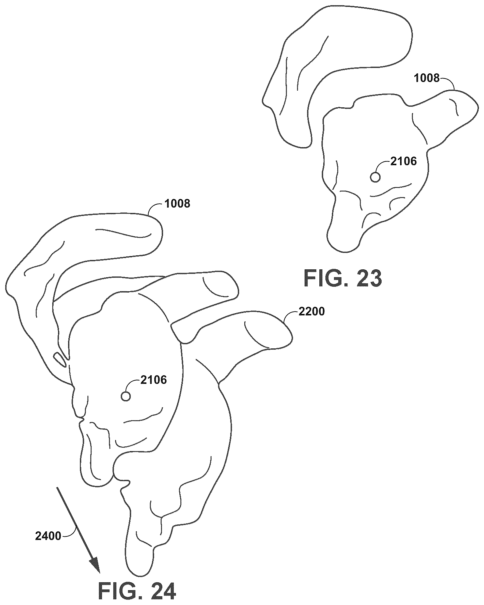 Patent US12347545 Figure 20 – Automated instrument or component assistance using externally controlled light sources in orthopedic surgical procedures