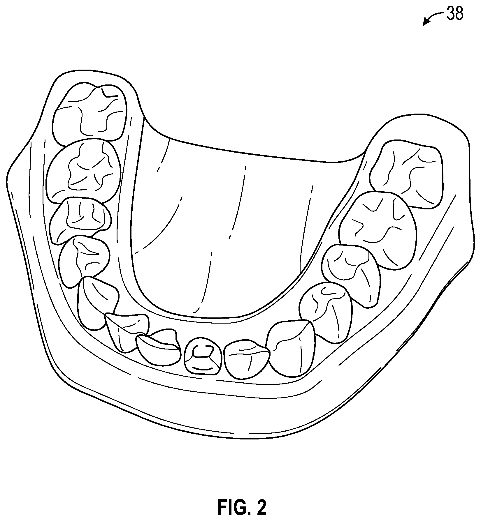 Patent US12347546 Figure 2 – Virtual articulation model for dental treatment
