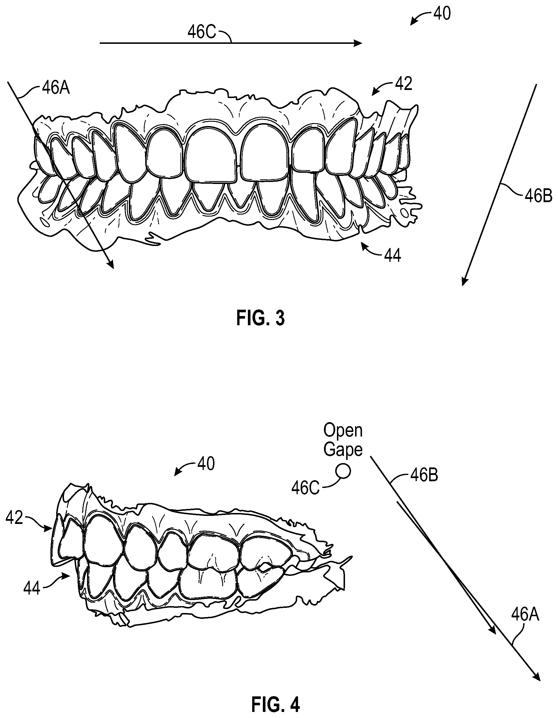 Patent US12347546 Figure 3 – Virtual articulation model for dental treatment