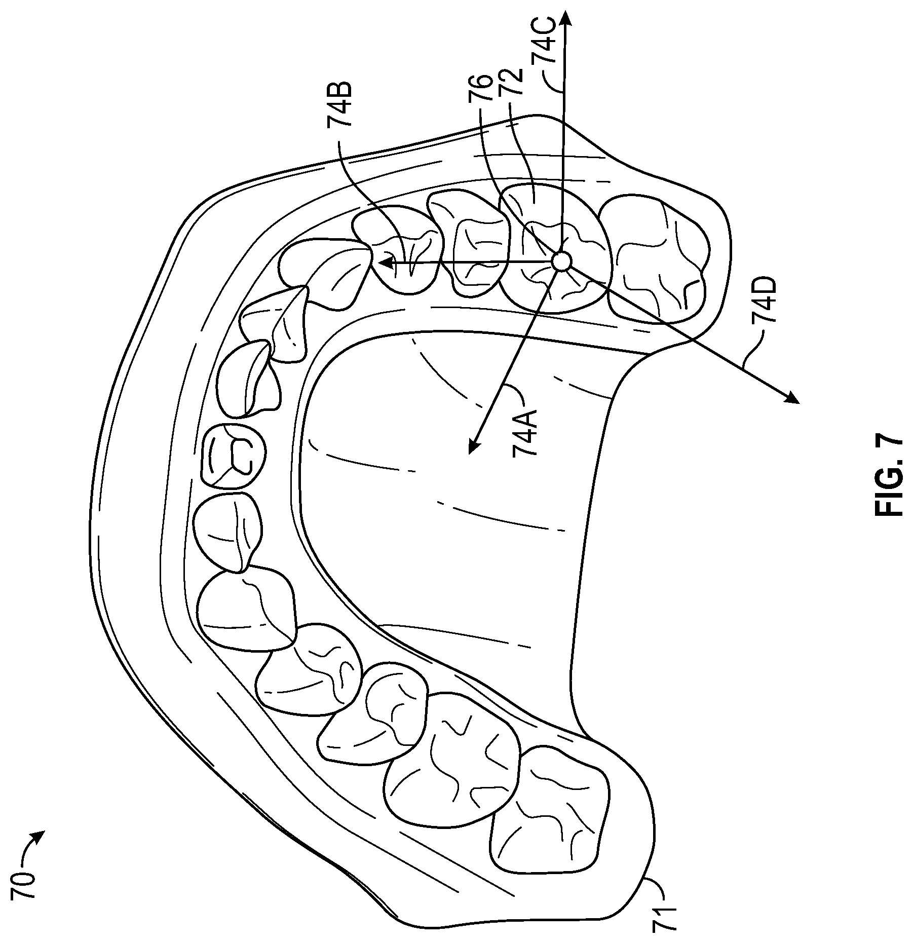 Patent US12347546 Figure 6 – Virtual articulation model for dental treatment
