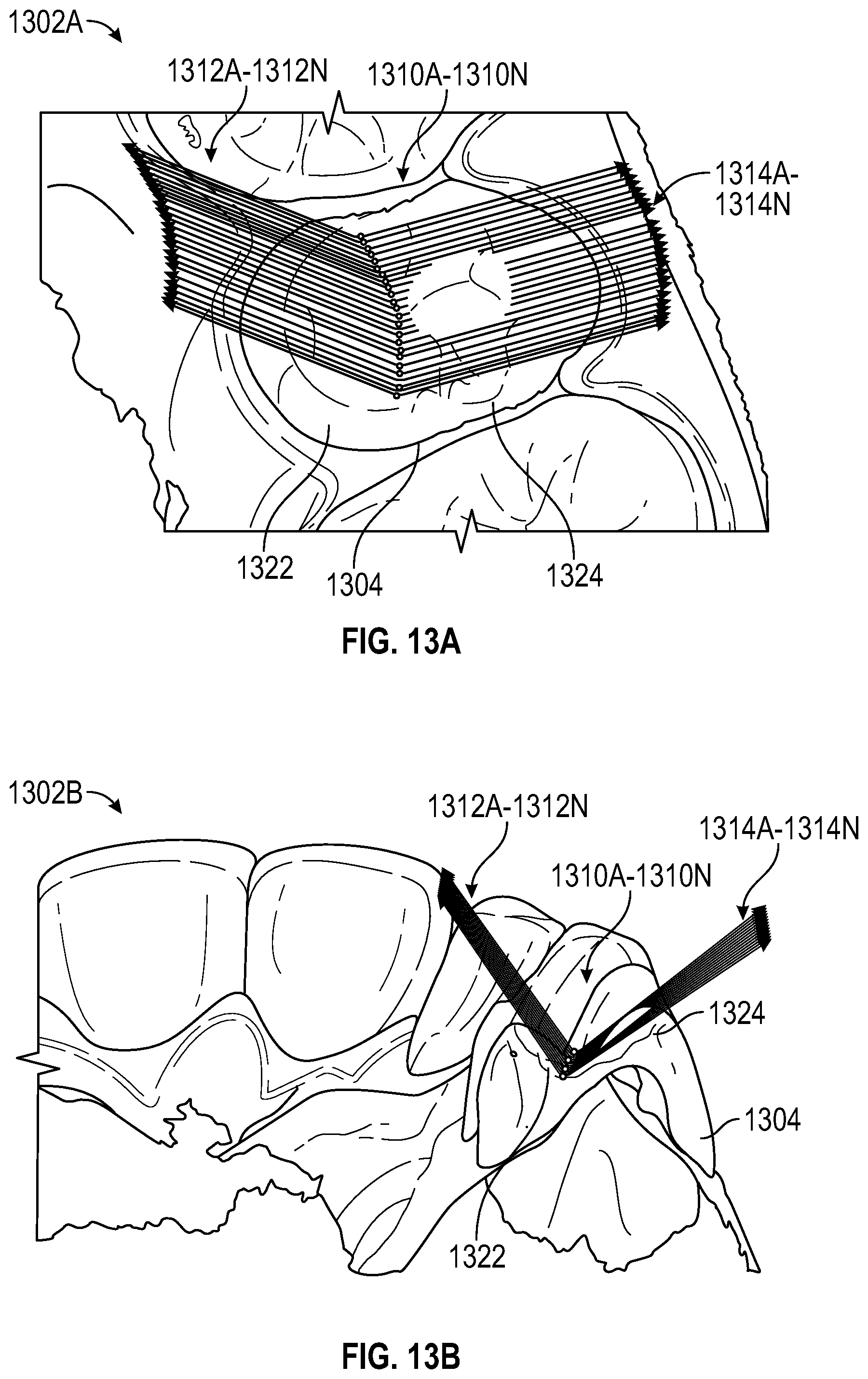 Patent US12347546 Figure 11 – Virtual articulation model for dental treatment