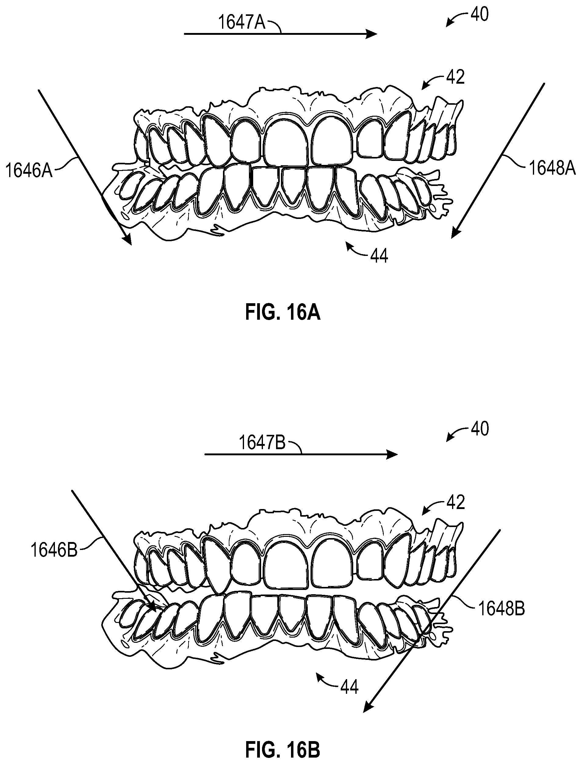 Patent US12347546 Figure 13 – Virtual articulation model for dental treatment