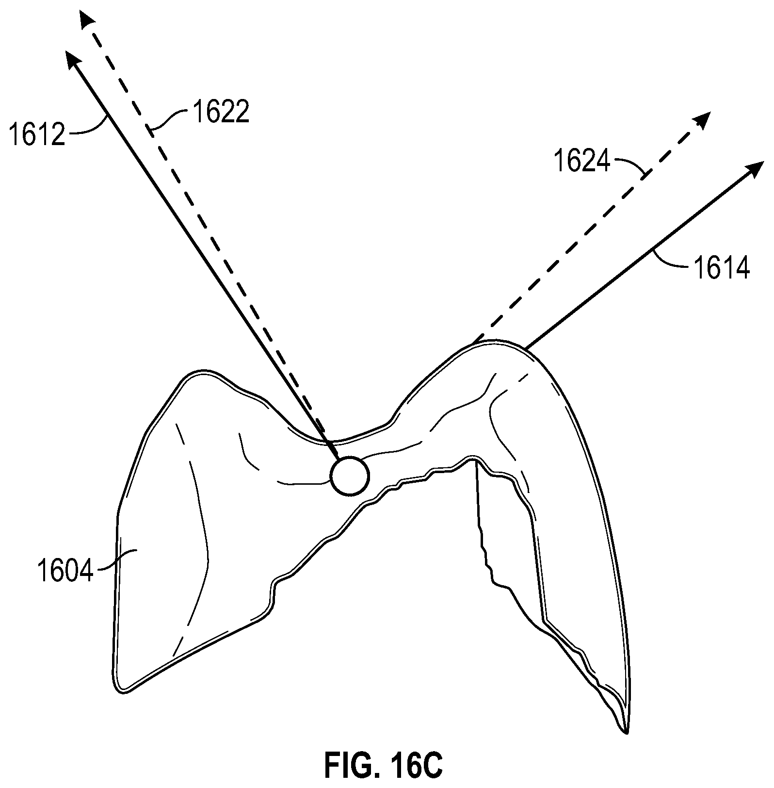 Patent US12347546 Figure 14 – Virtual articulation model for dental treatment