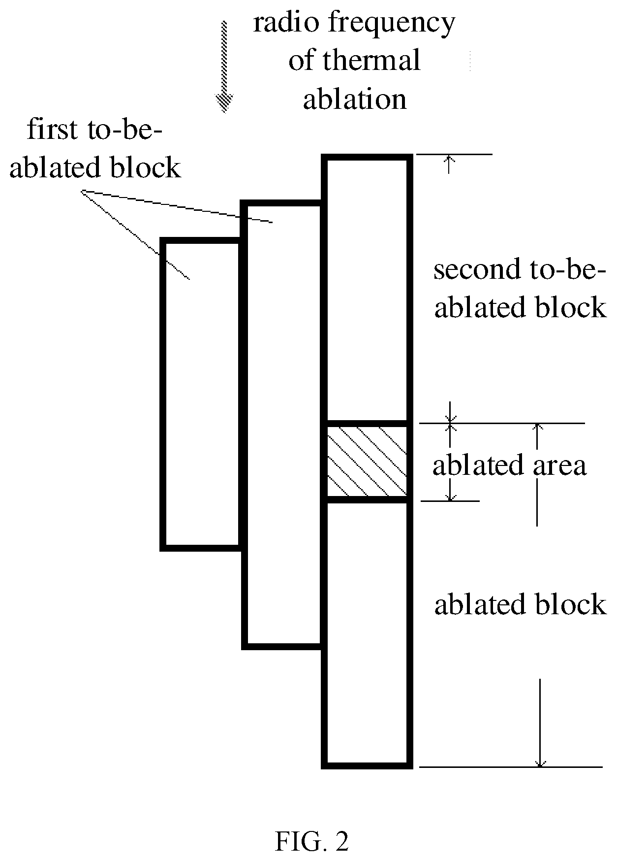 Patent US12347547 Figure 2 – Automatic planning method and device for tissue ablation