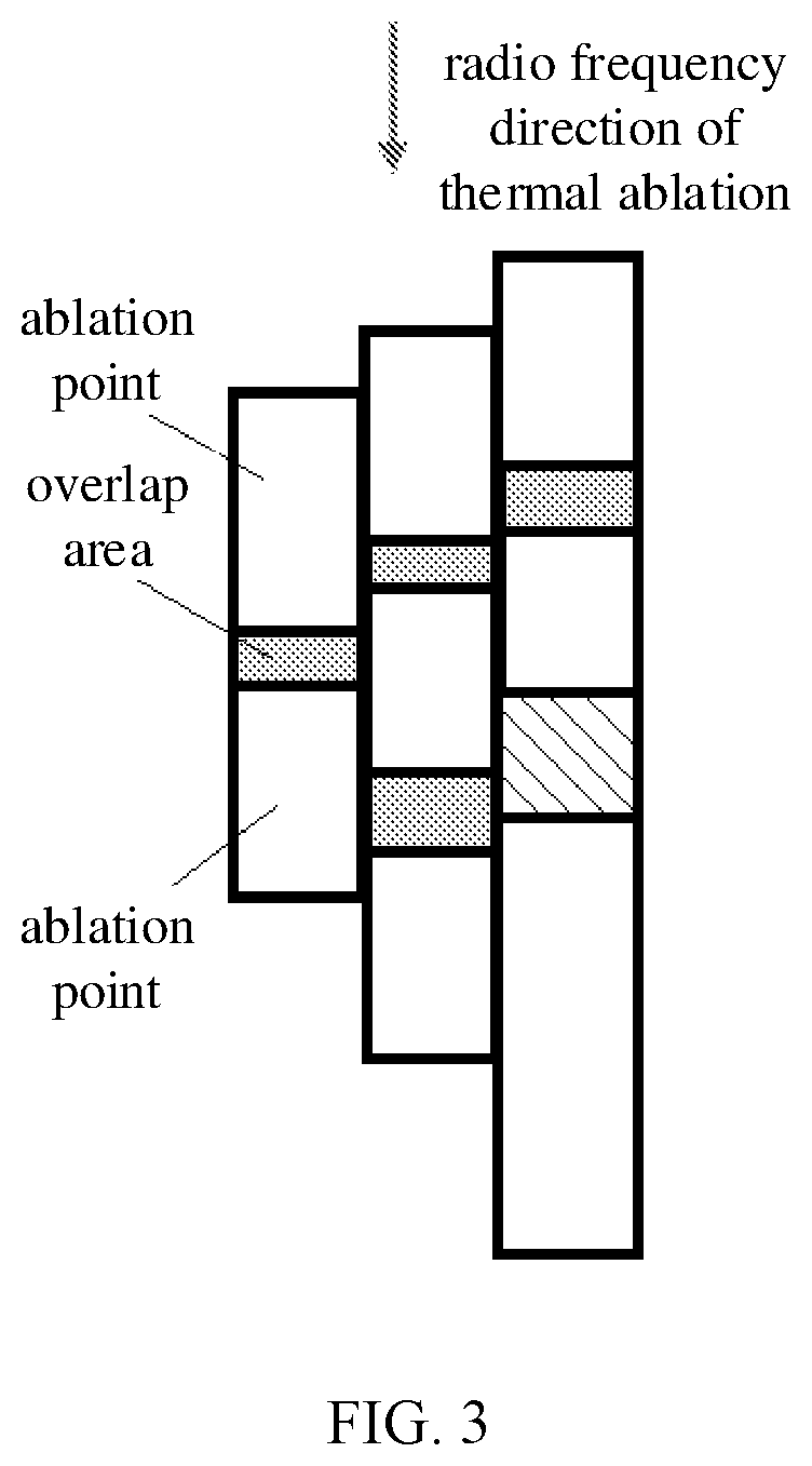 Patent US12347547 Figure 3 – Automatic planning method and device for tissue ablation
