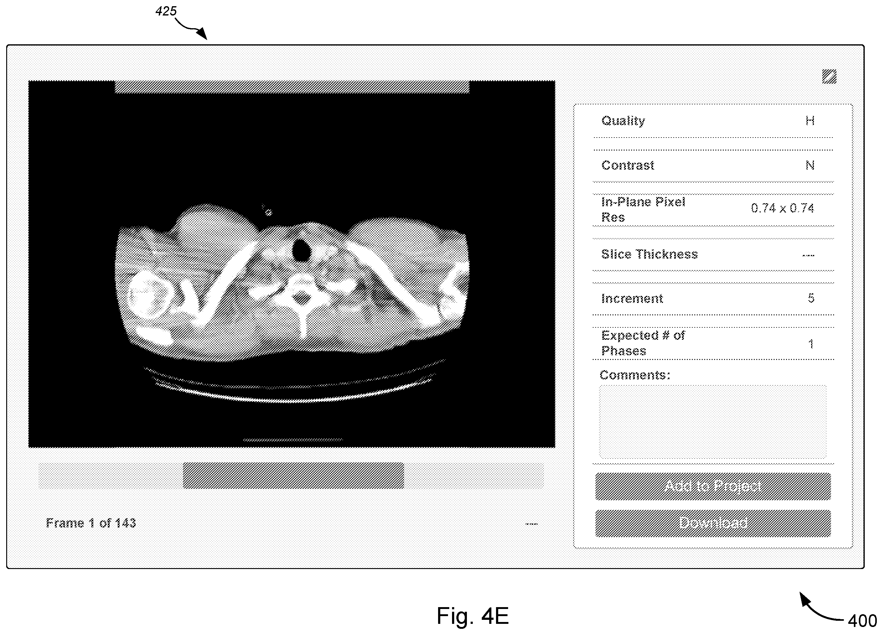 Patent US12347550 Figure 11 – Imaging discovery utility for augmenting clinical image management