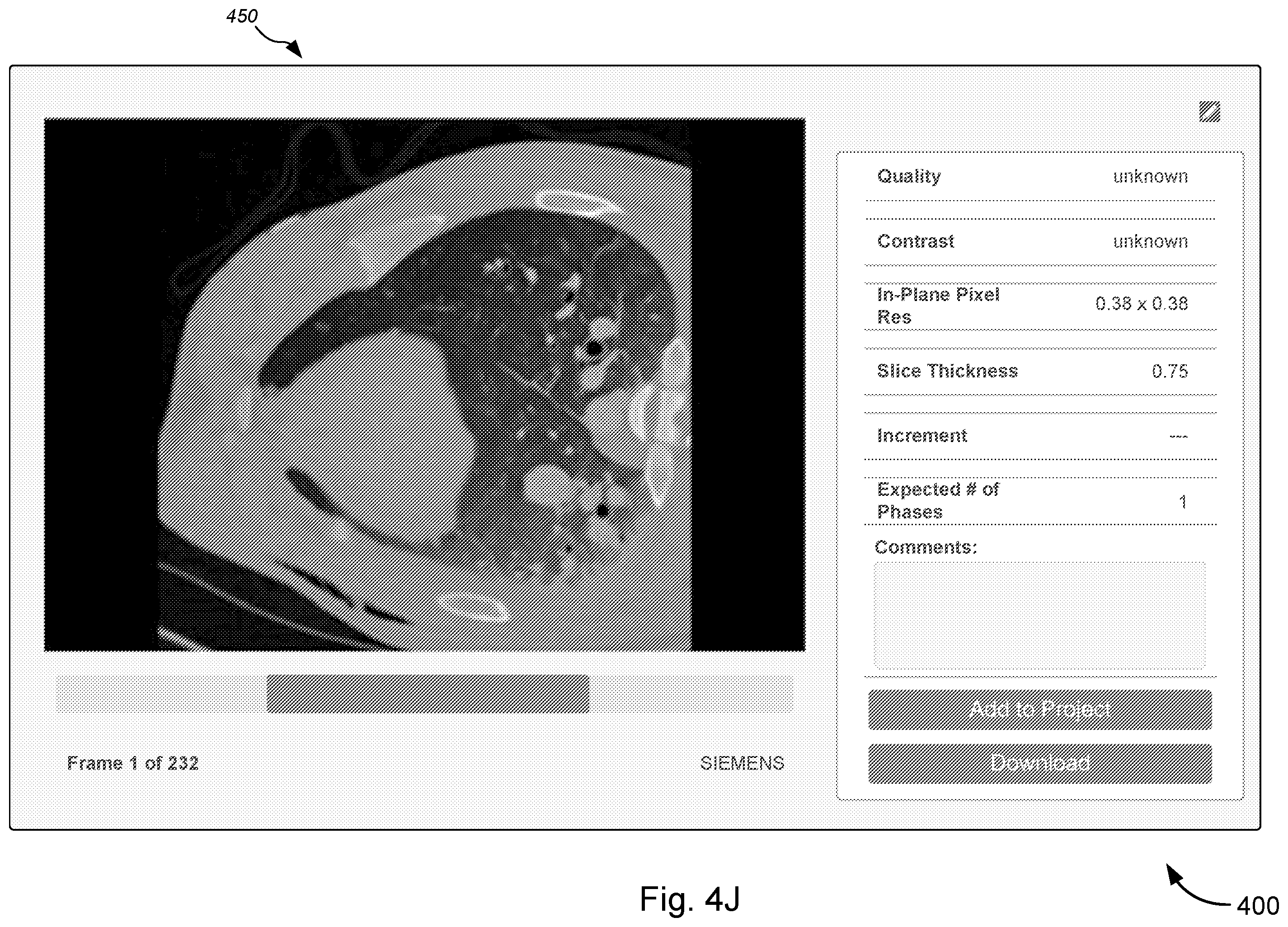 Patent US12347550 Figure 16 – Imaging discovery utility for augmenting clinical image management