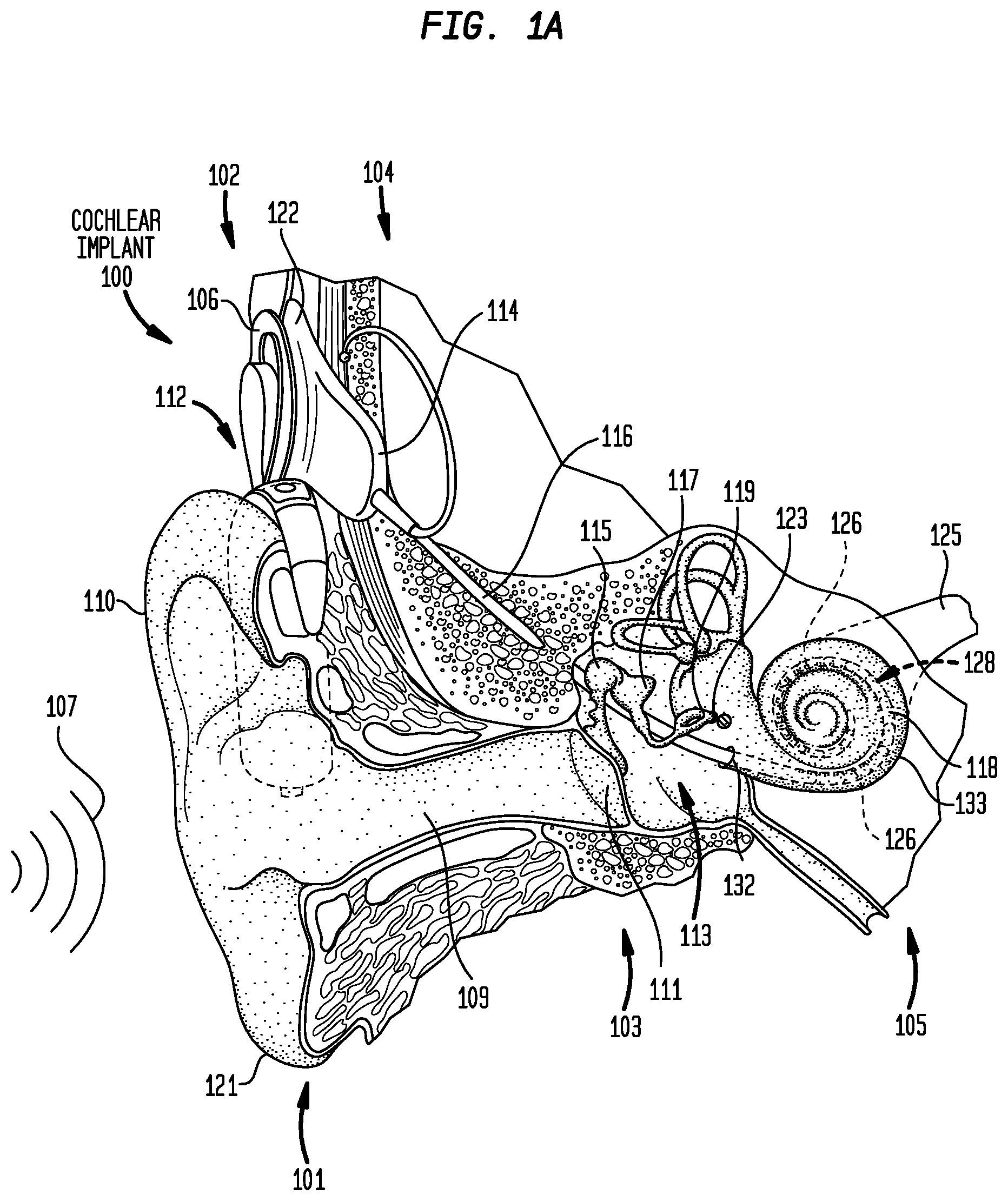 Patent US12347554 Figure 1 – Dynamic virtual hearing modelling