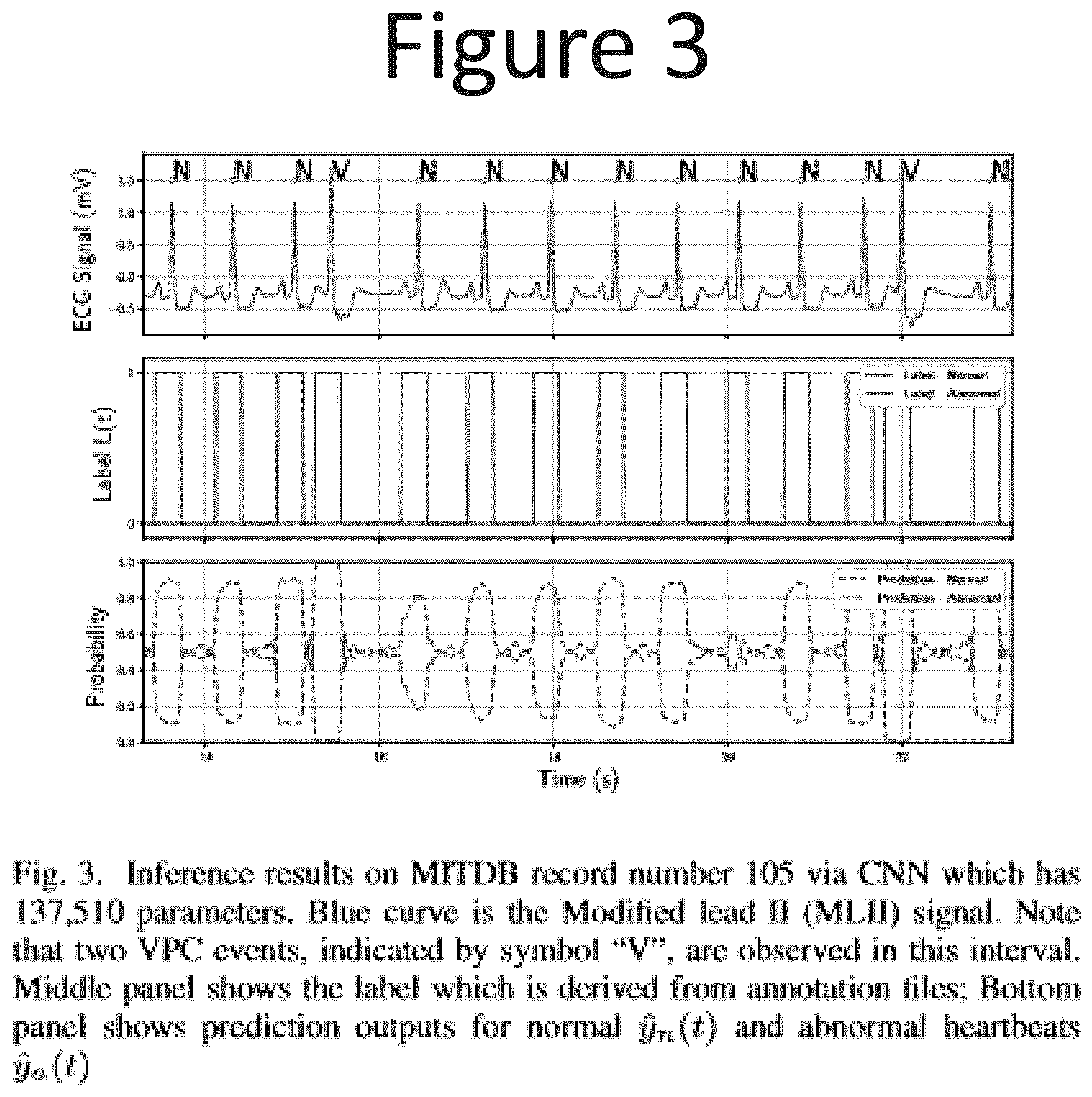 Patent US12347557 Figure 3 – Deep neural network (DNN) assisted sensor for energy-efficient electrocardiogram (ECG) monitoring
