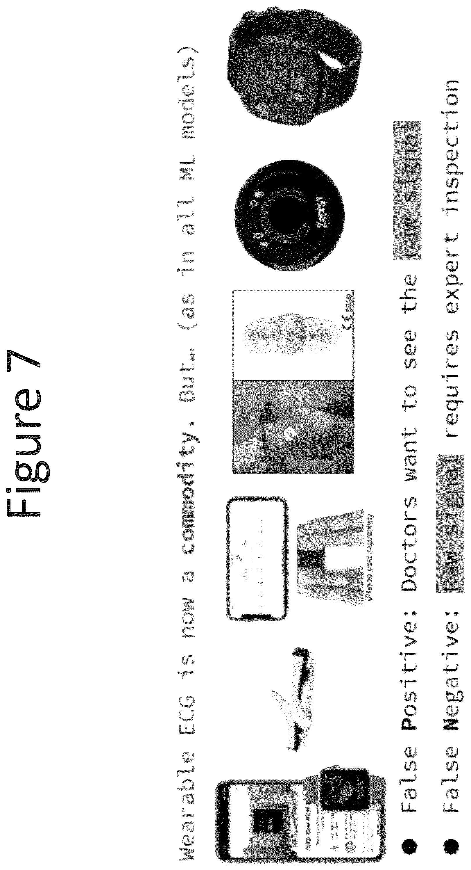 Patent US12347557 Figure 7 – Deep neural network (DNN) assisted sensor for energy-efficient electrocardiogram (ECG) monitoring