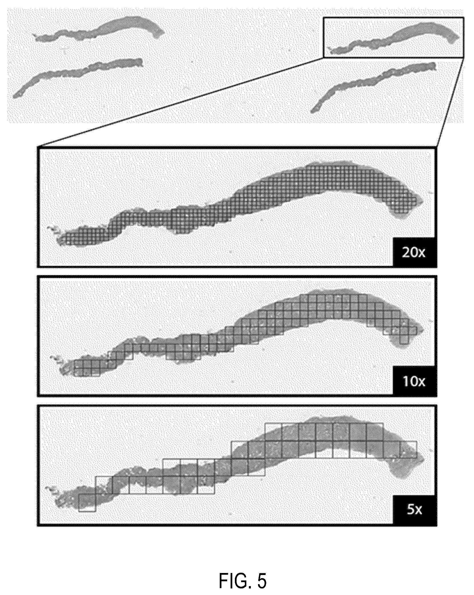 Patent US12347569 Figure 5 – Systems and methods for multiple instance learning for classification and localization in biomedical imaging