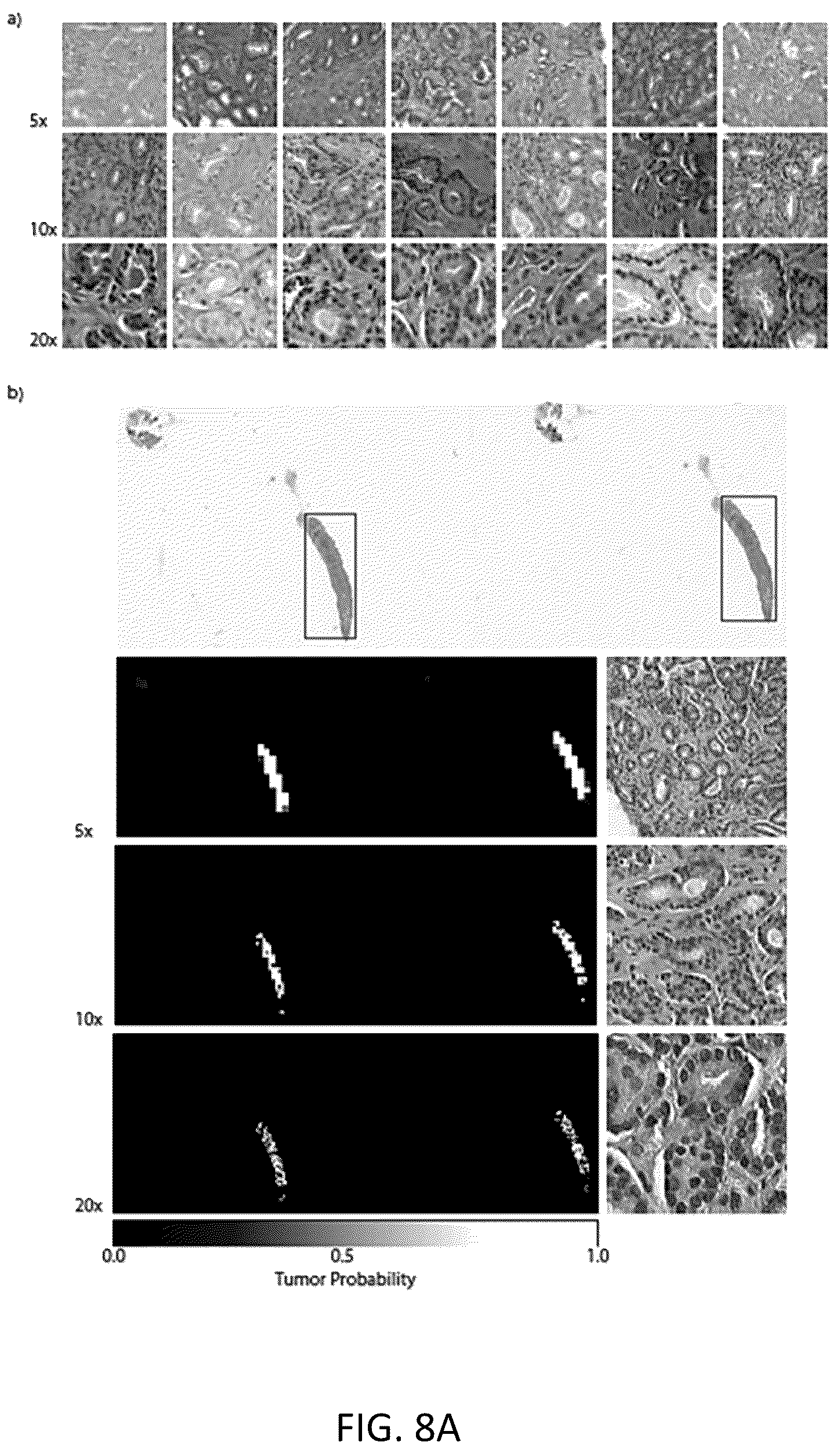 Patent US12347569 Figure 11 – Systems and methods for multiple instance learning for classification and localization in biomedical imaging