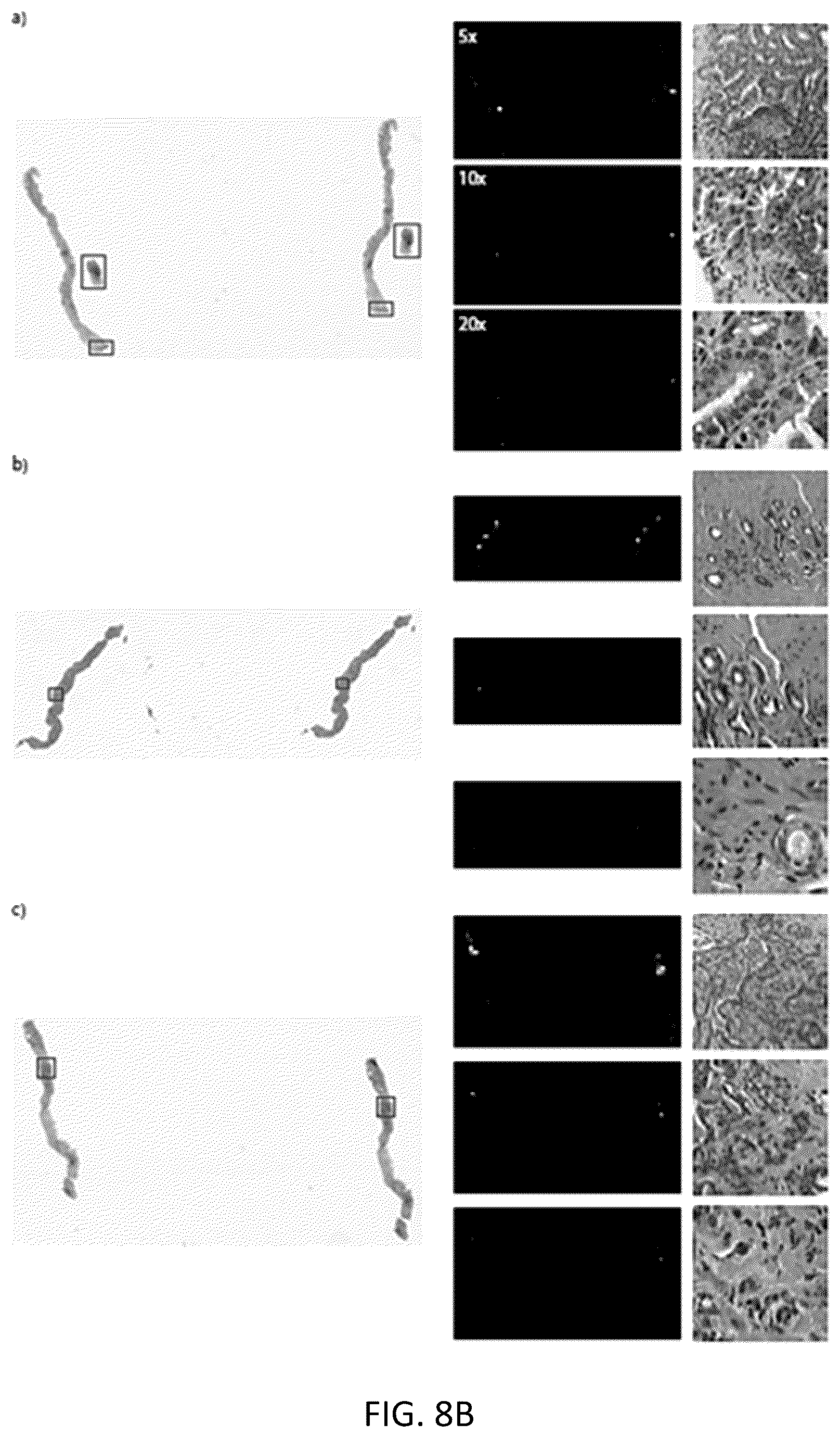 Patent US12347569 Figure 12 – Systems and methods for multiple instance learning for classification and localization in biomedical imaging