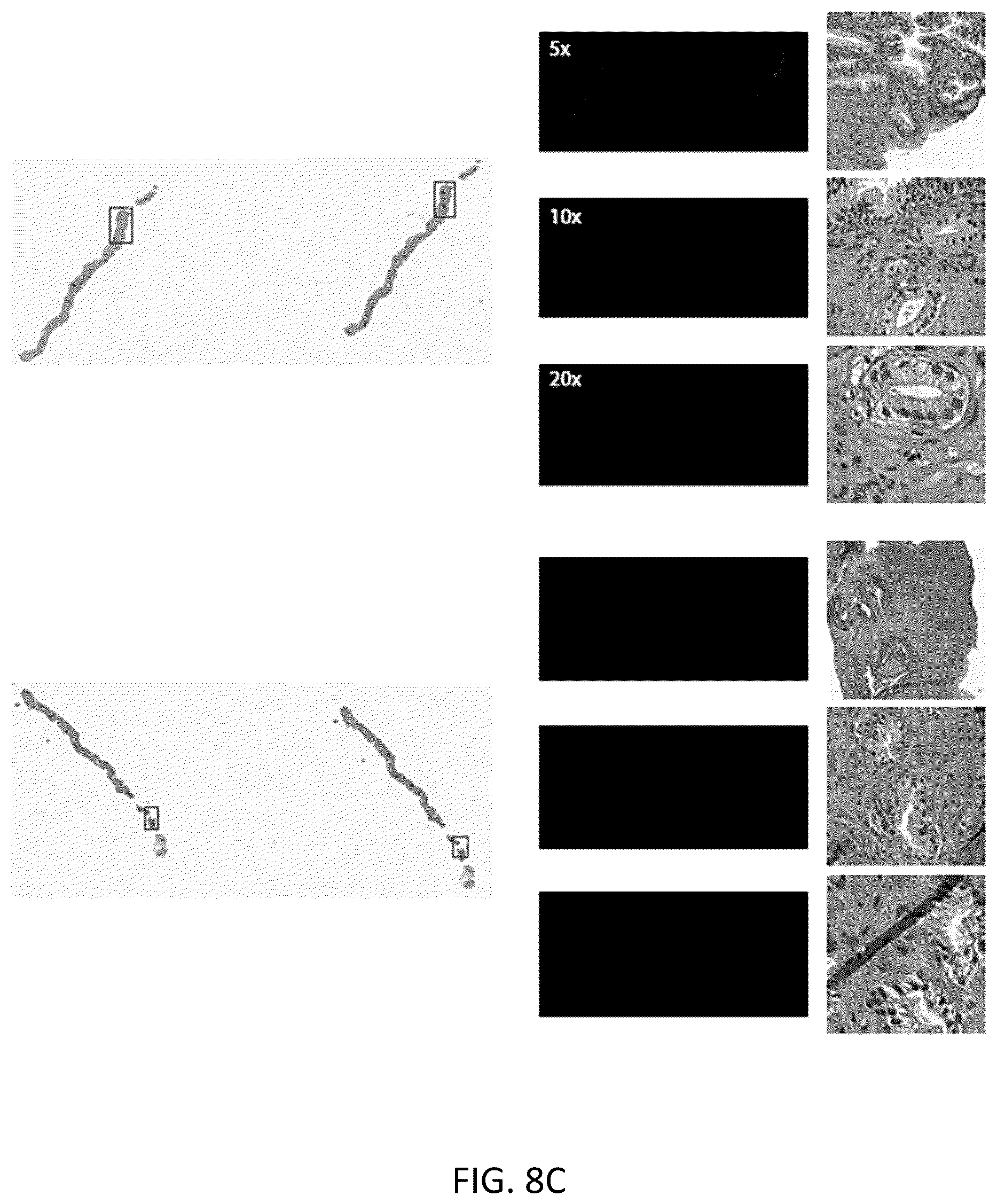 Patent US12347569 Figure 13 – Systems and methods for multiple instance learning for classification and localization in biomedical imaging