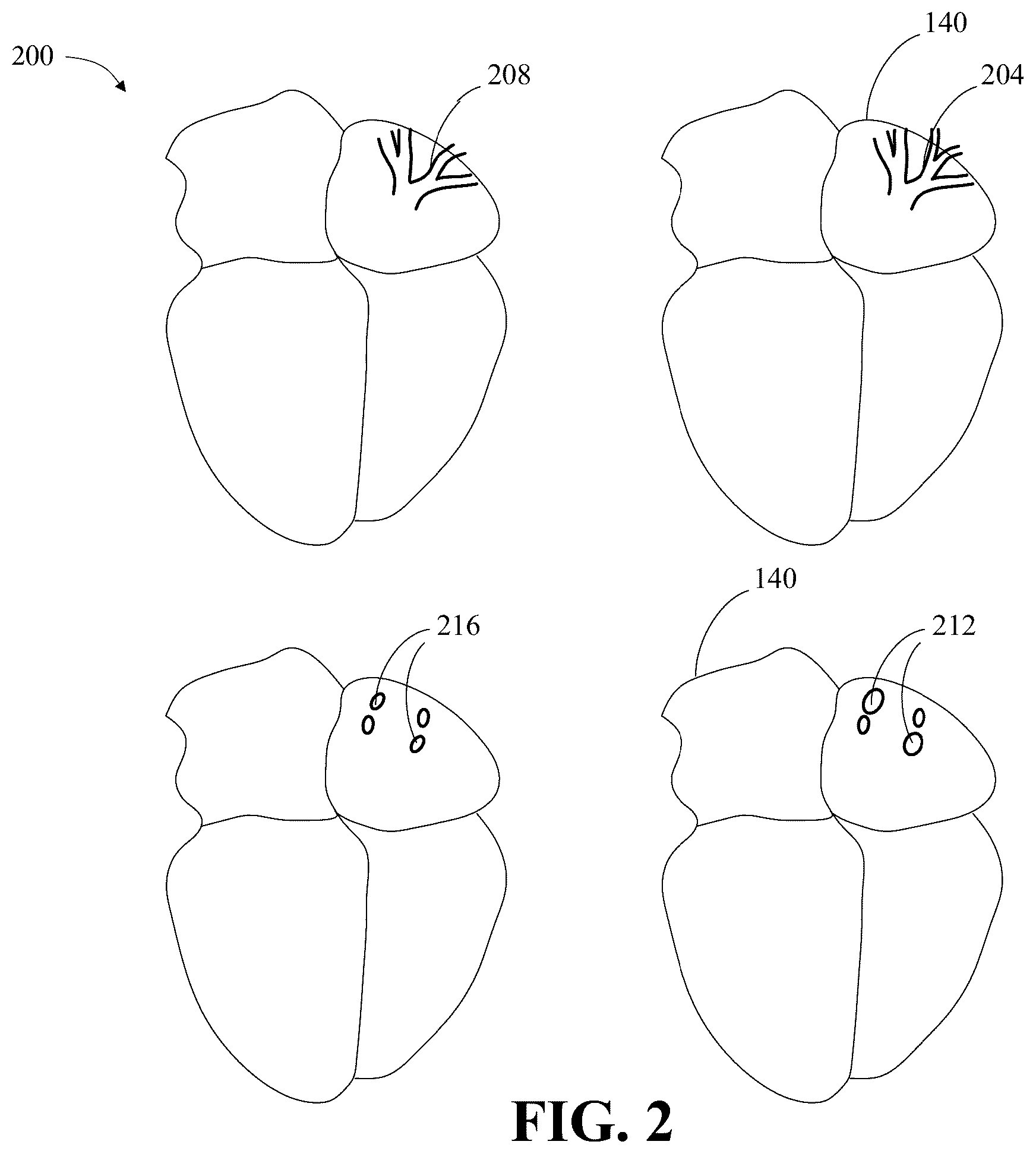 Patent US12347570 Figure 2 – Apparatus and methods for attribute detection in anatomy data
