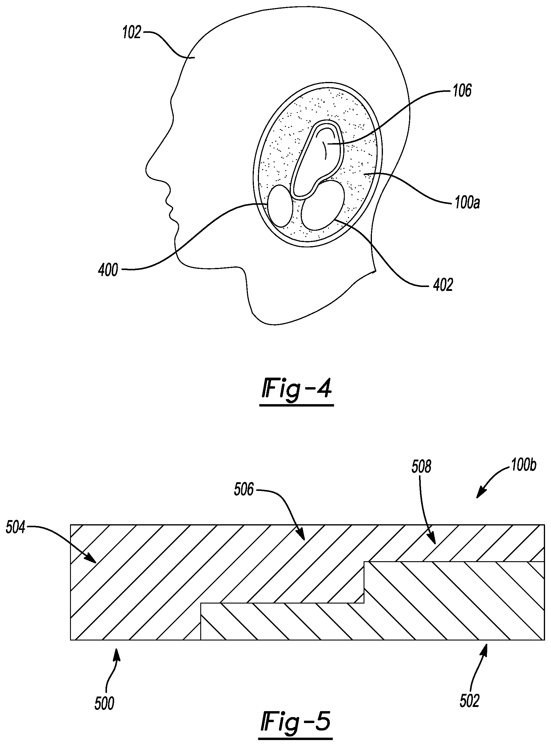 Patent US12348919 Figure 4 – Insert for headphone measurements on a head shaped fixture