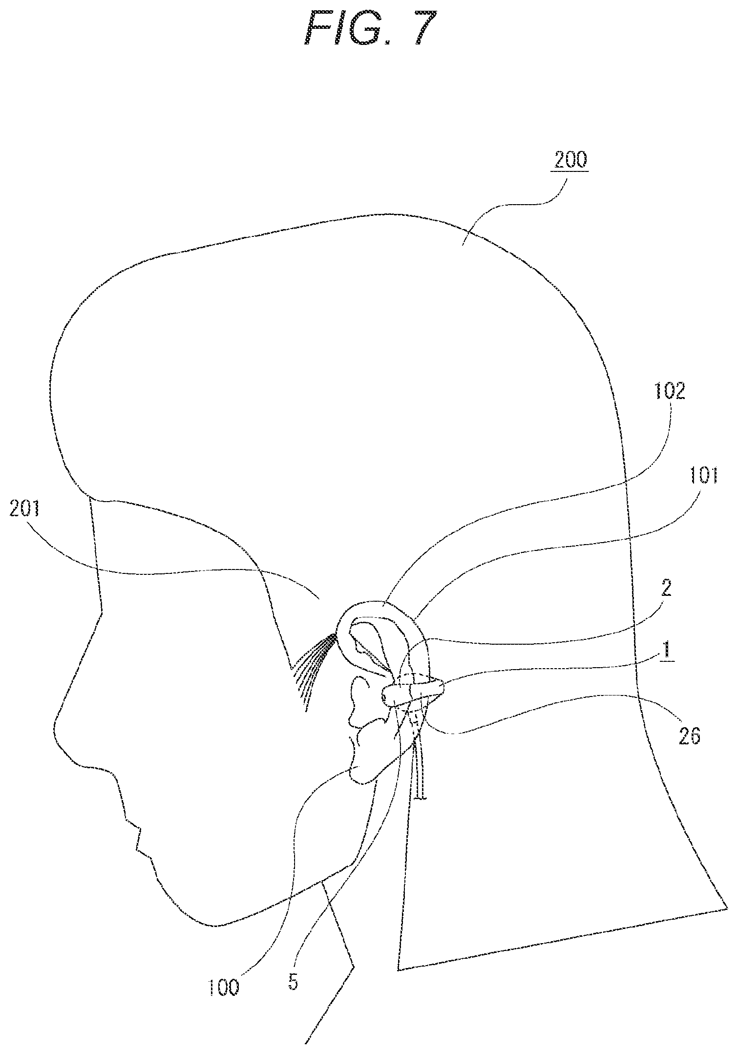 Patent US12348922 Figure 7 – Sound output device