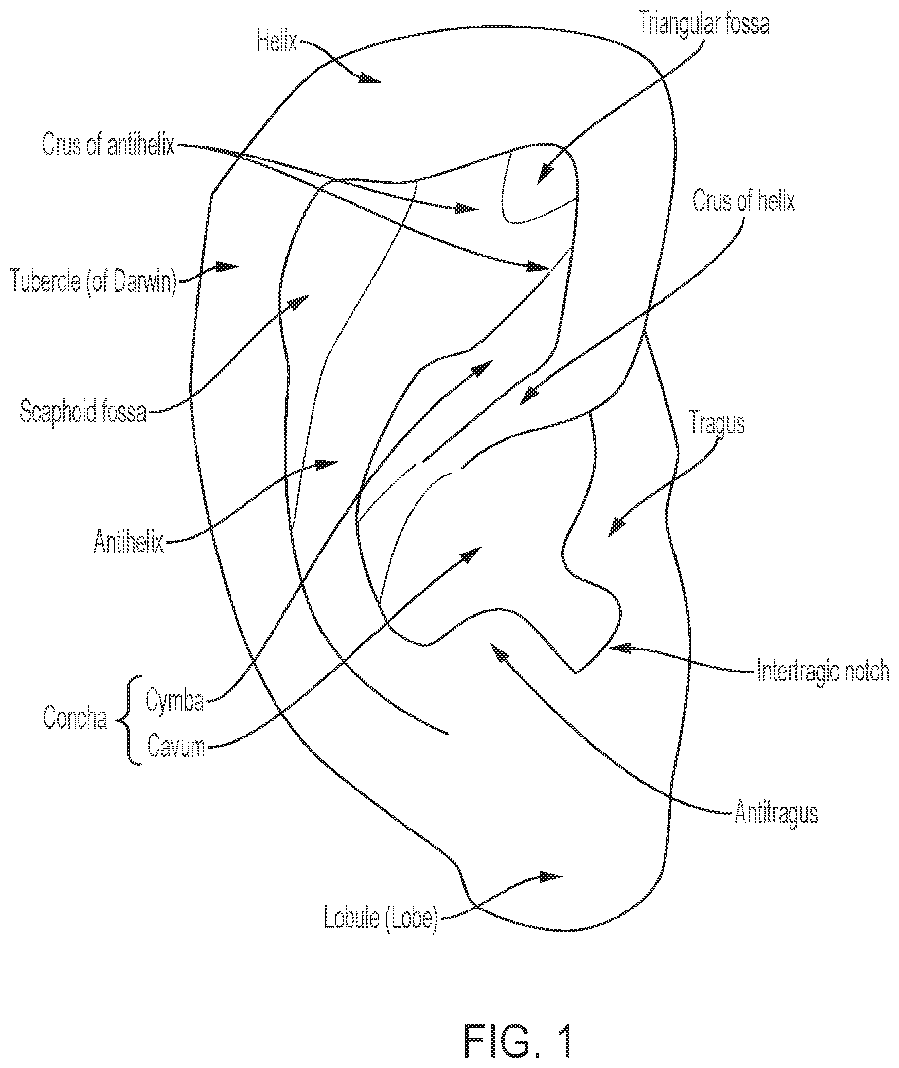 Patent US12348925 Figure 1 – Ringed-shaped biometric earpiece