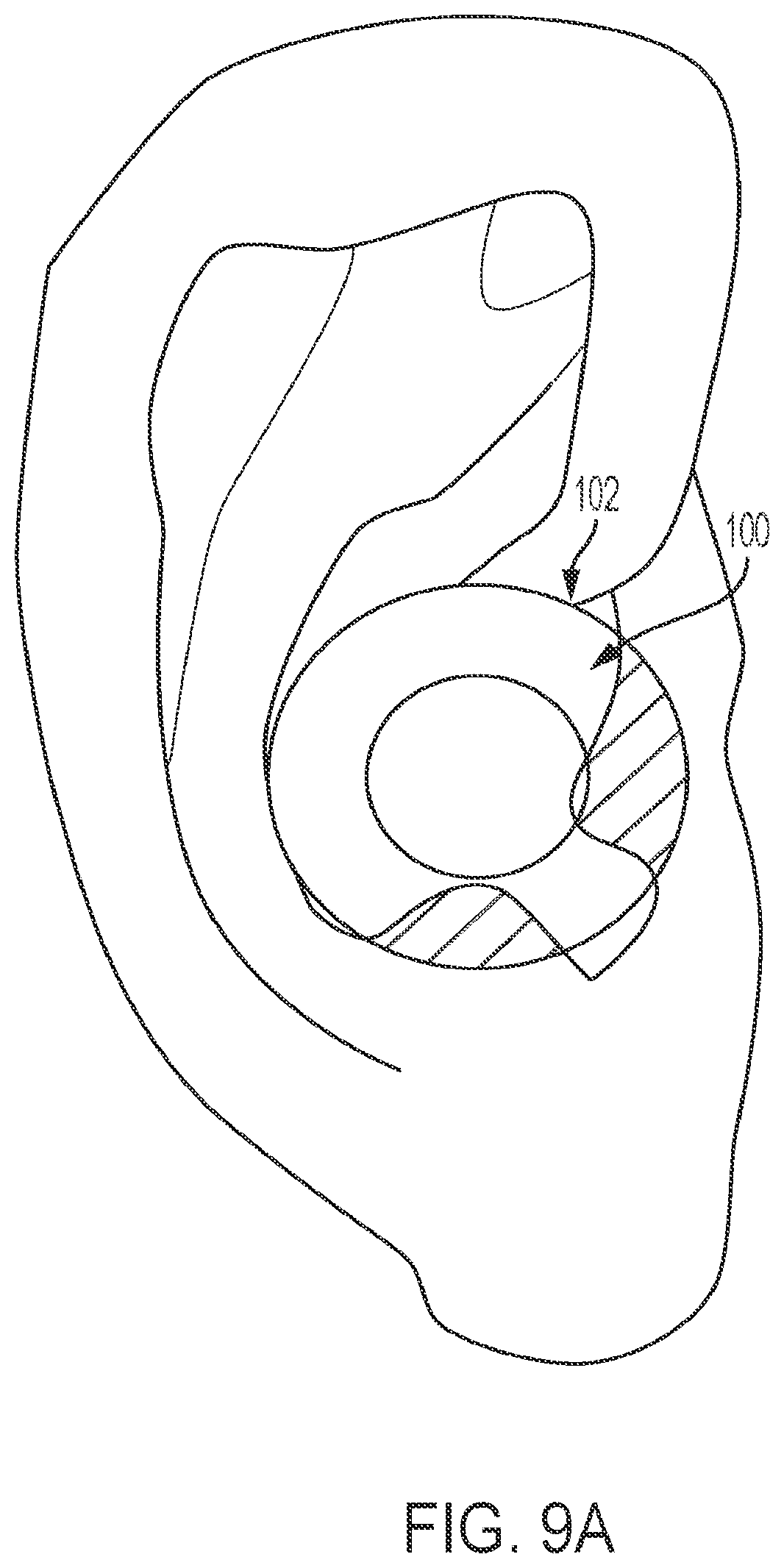 Patent US12348925 Figure 13 – Ringed-shaped biometric earpiece